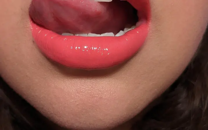 LovelyWatermelon1 / MoodyWatermelon1