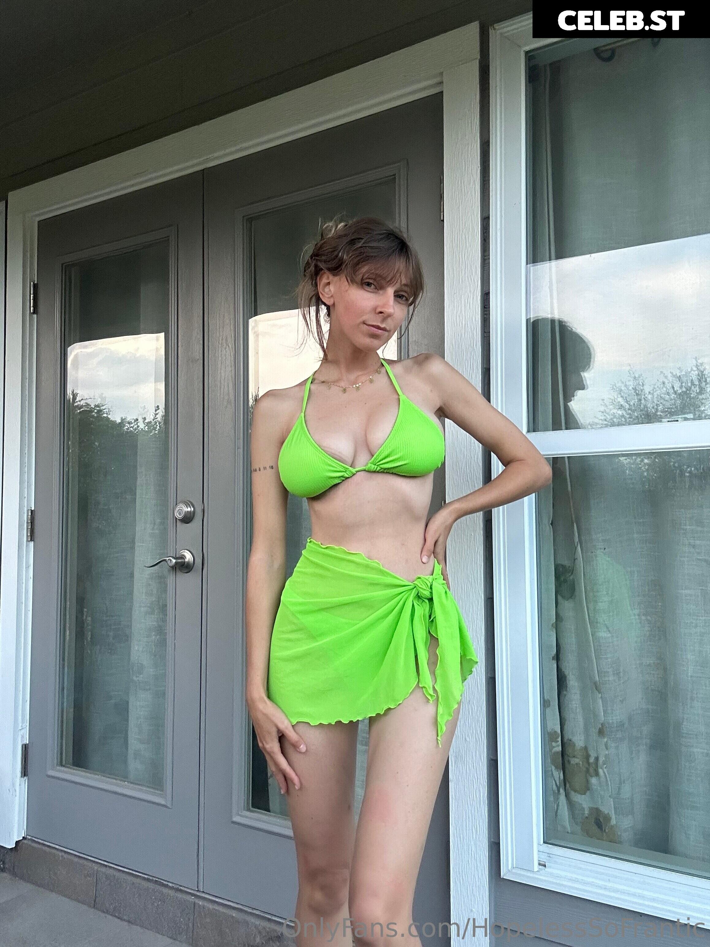 Hopelesssofrantic Image 9865617