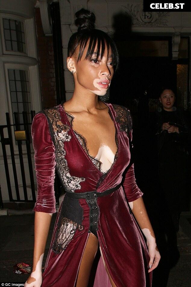 Winnie Harlow Image 9943744