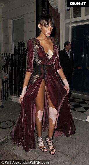 Winnie Harlow Image 9943734