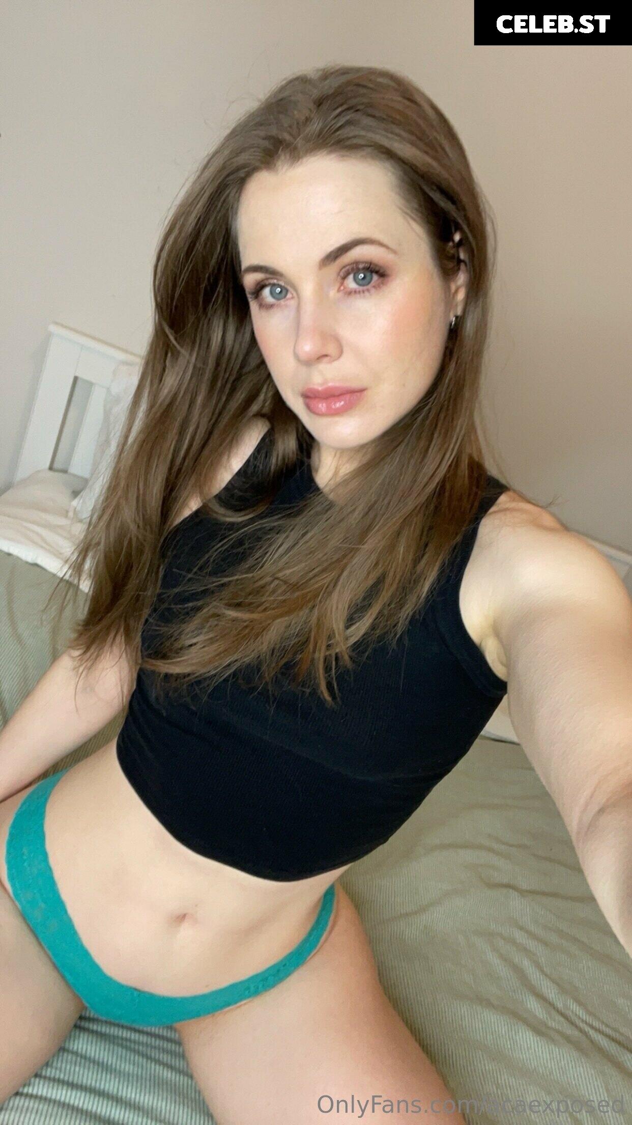 Acaexposed Image 2356313