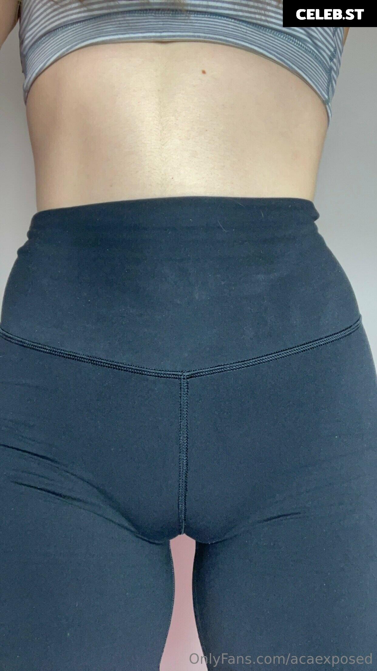 Acaexposed Image 2351920