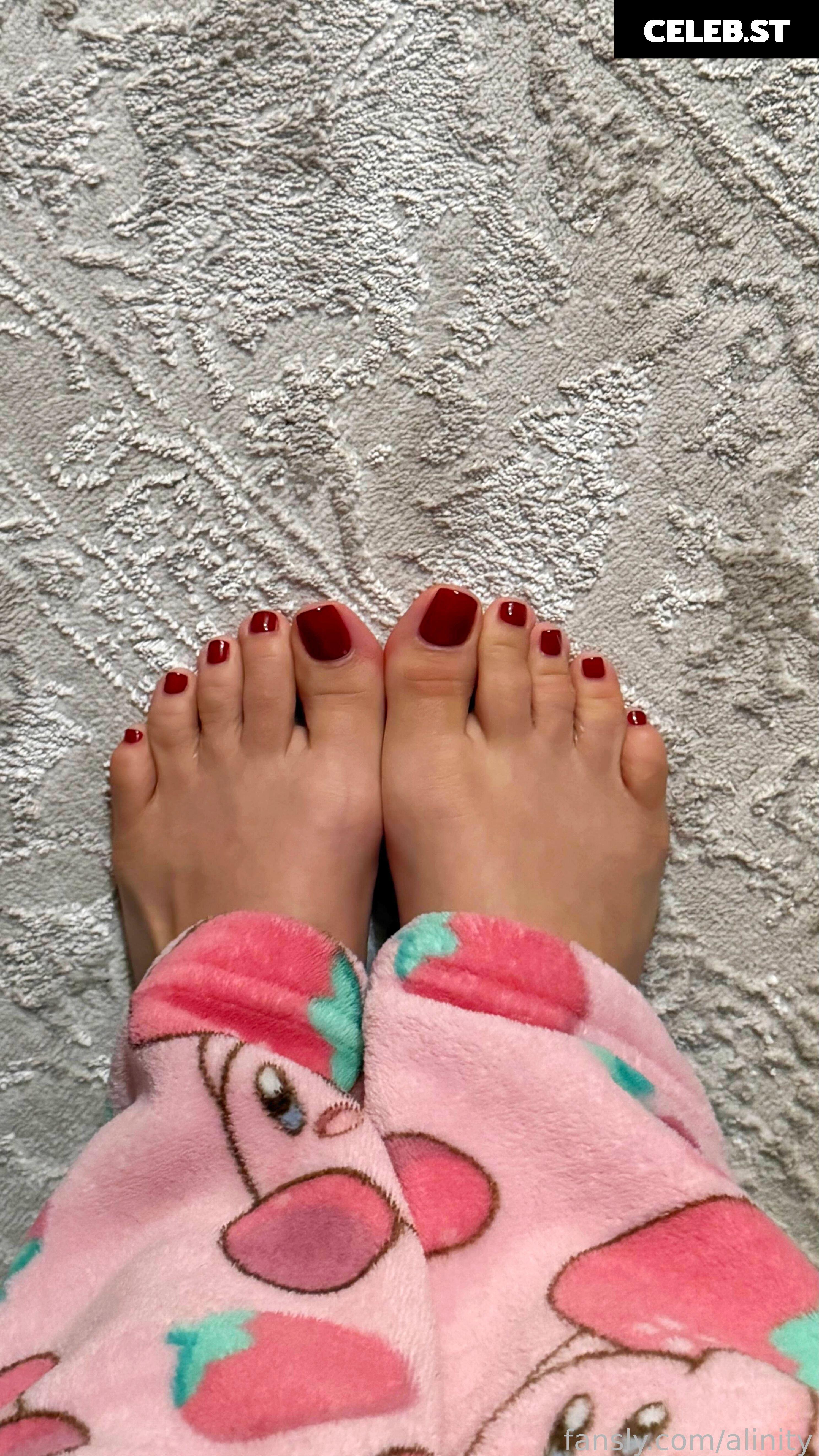 Alinity Image 23274413