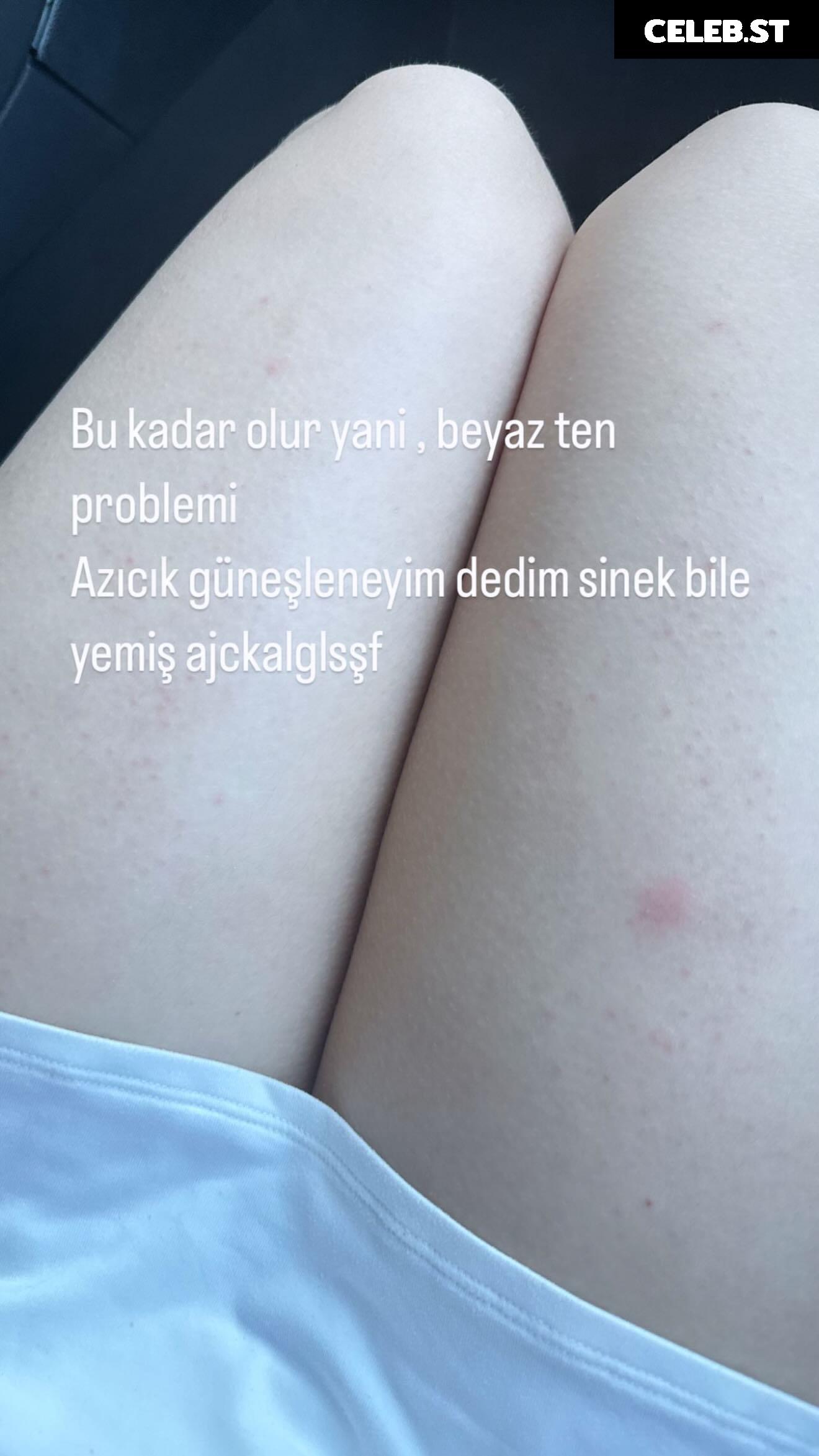 ecbsnn Ece Başaran Image 24816005