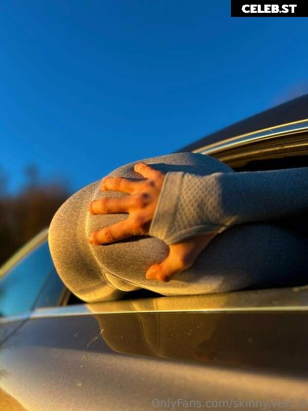 Skinny.ver1.0 Image 2697792