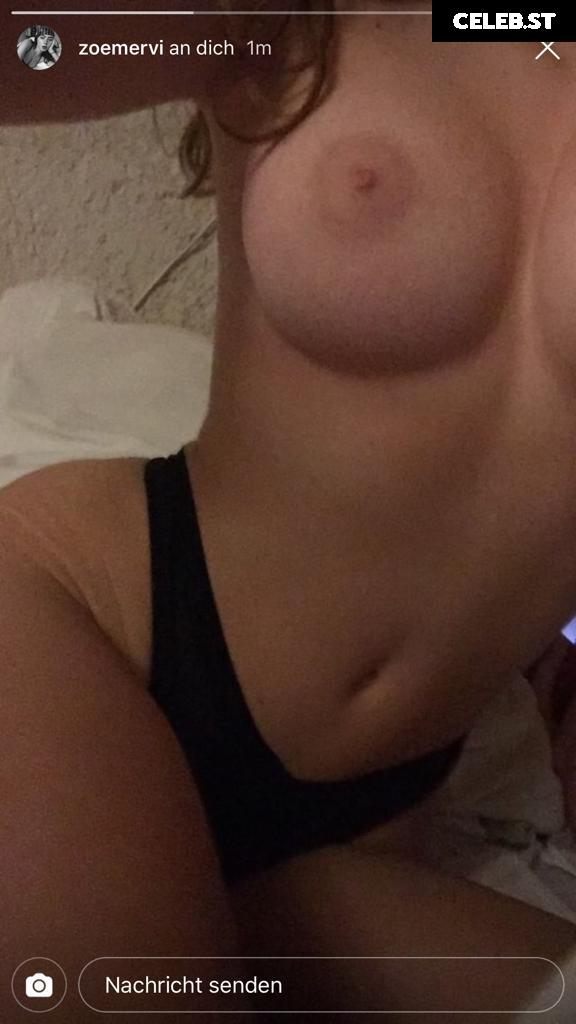 Zoe Mervie Image 26383982