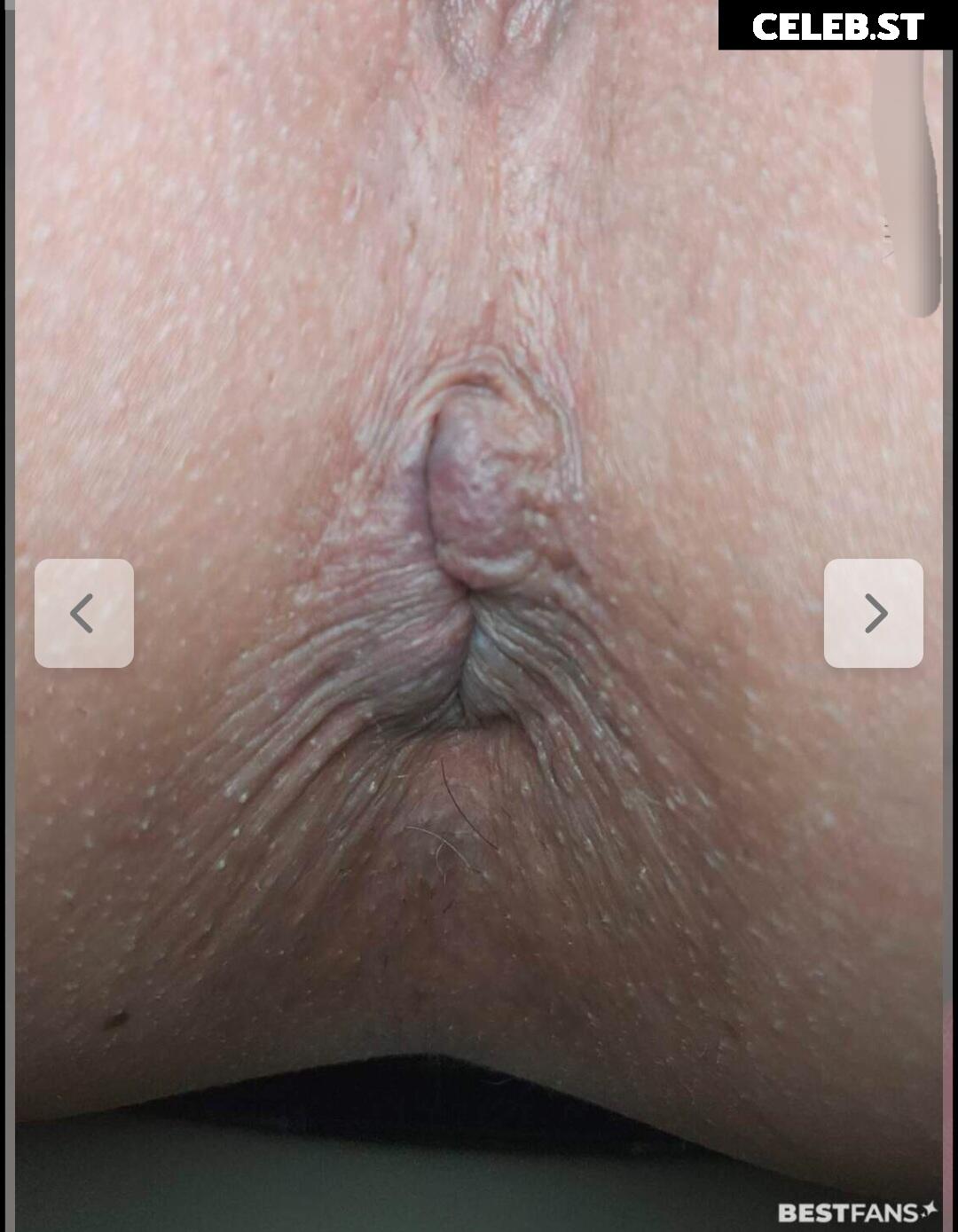steff-fanny-dr Image 2782197