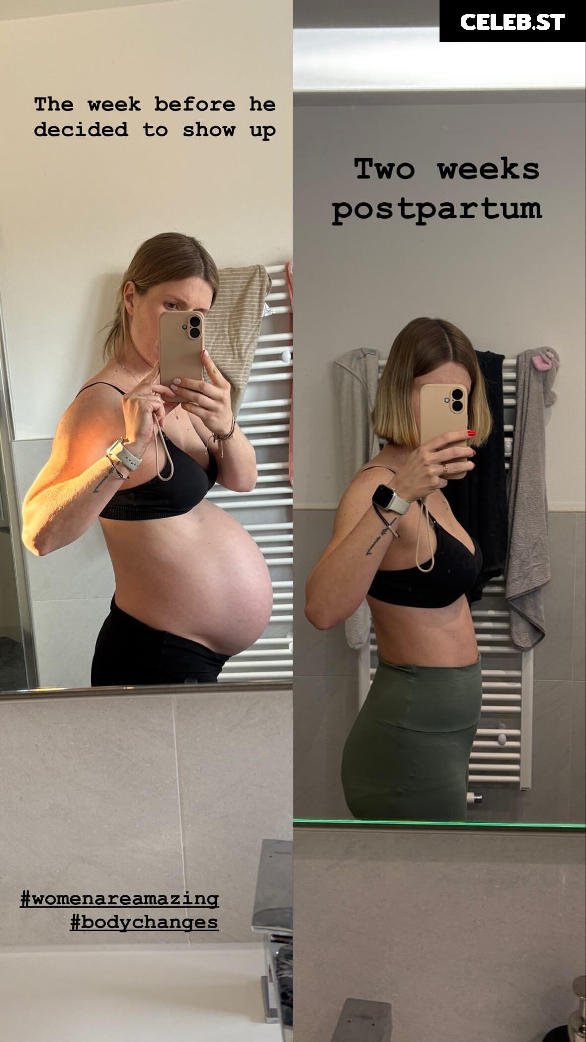 Pregnant Image 27155675
