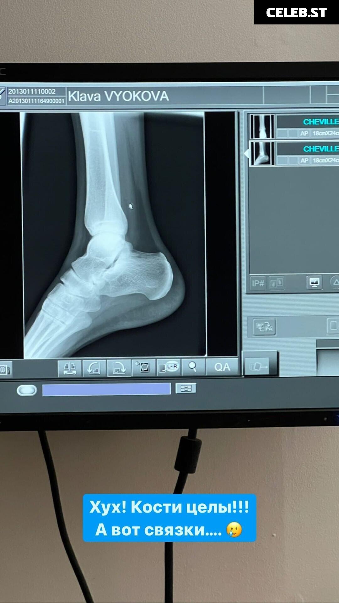 Klava Koka Image 20835852