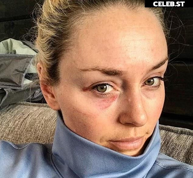 Lindsey Vonn Image 2068559