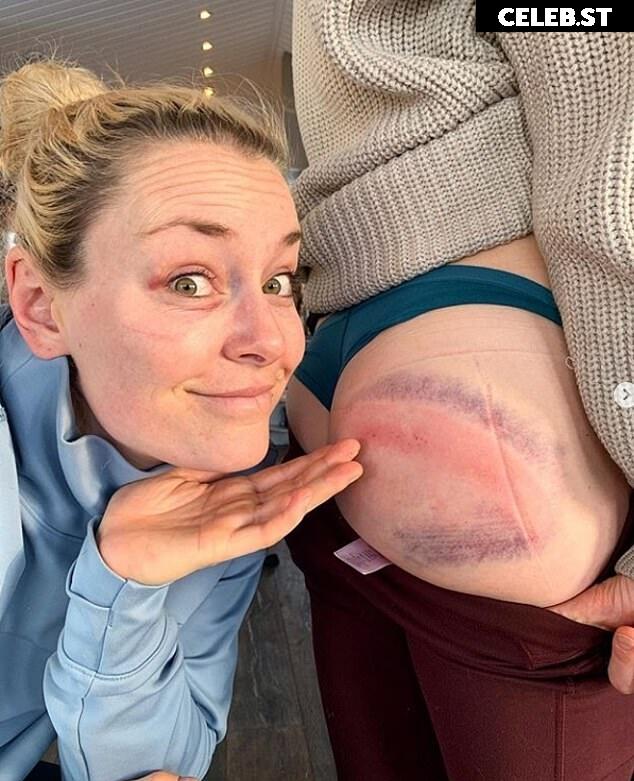 Lindsey Vonn Image 2068536
