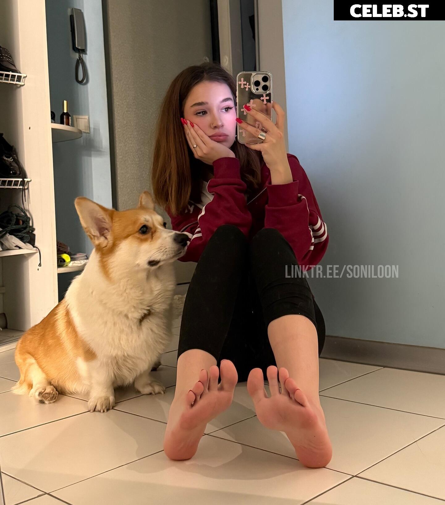 Soniloon / soniloonxx / soniww22 / sonixyu Image 11978038