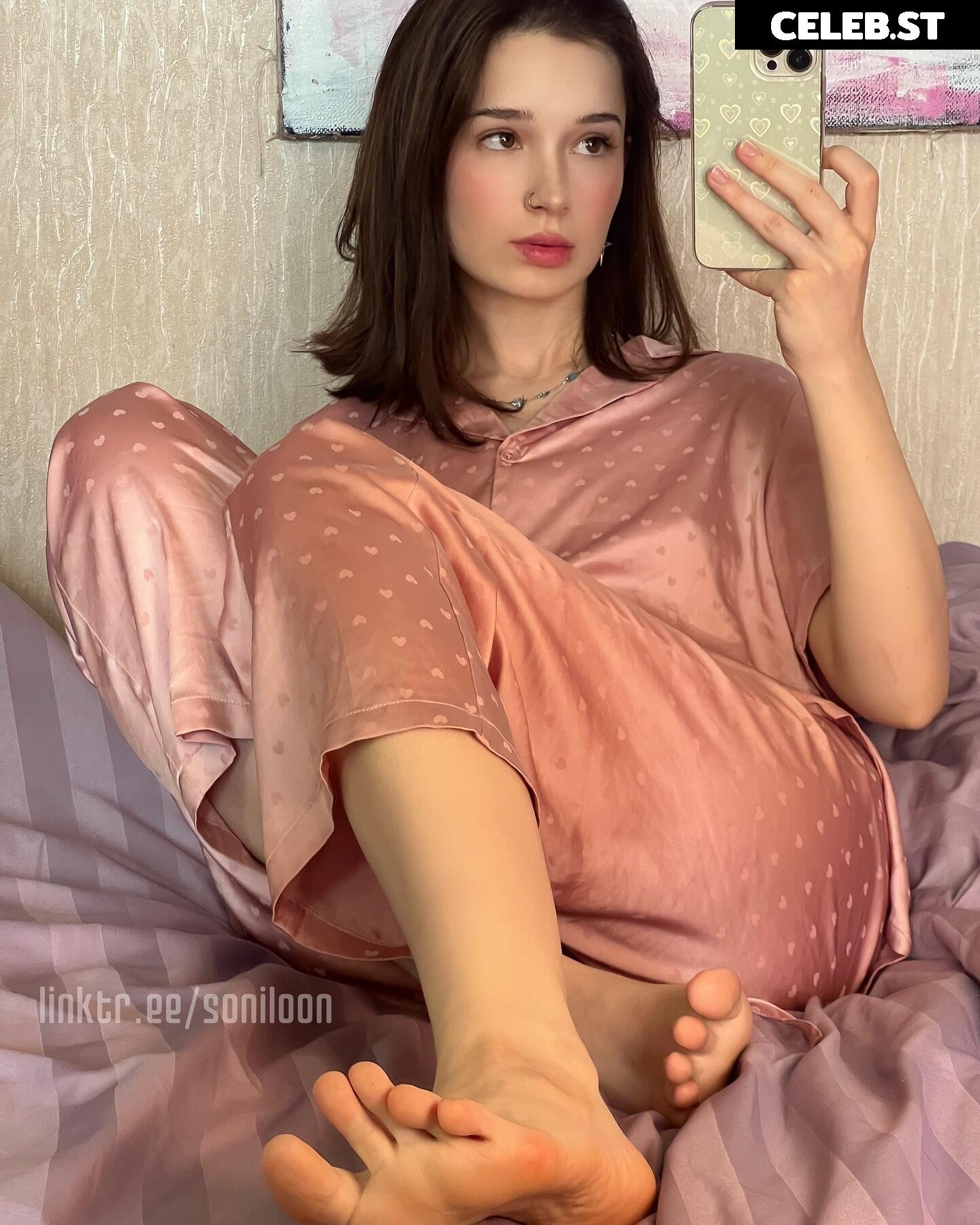 Soniloon / soniloonxx / soniww22 / sonixyu Image 11977987