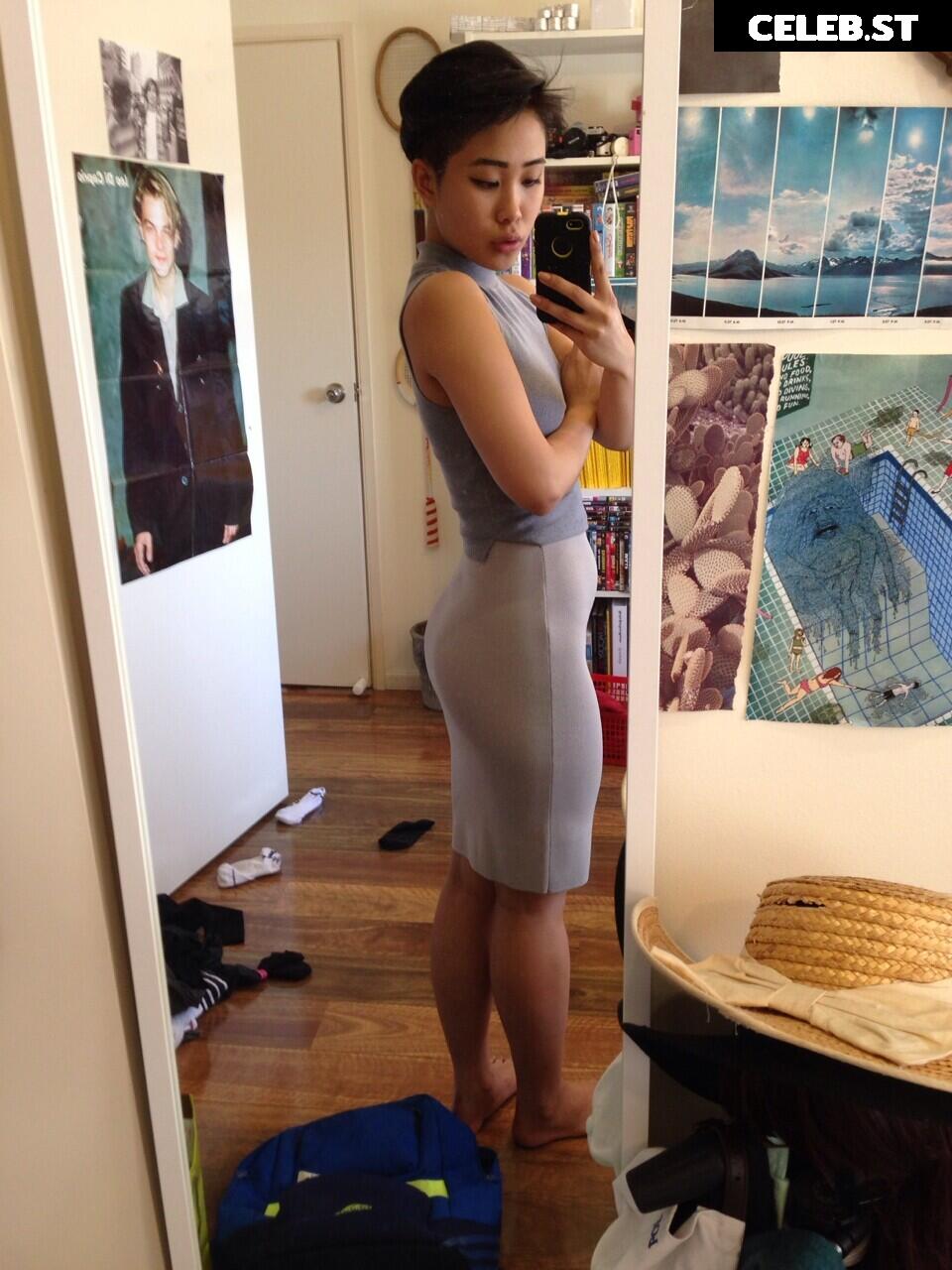 nickjonastillhasdiabetes Image 11993125