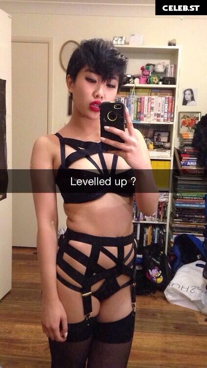 nickjonastillhasdiabetes Image 11993111