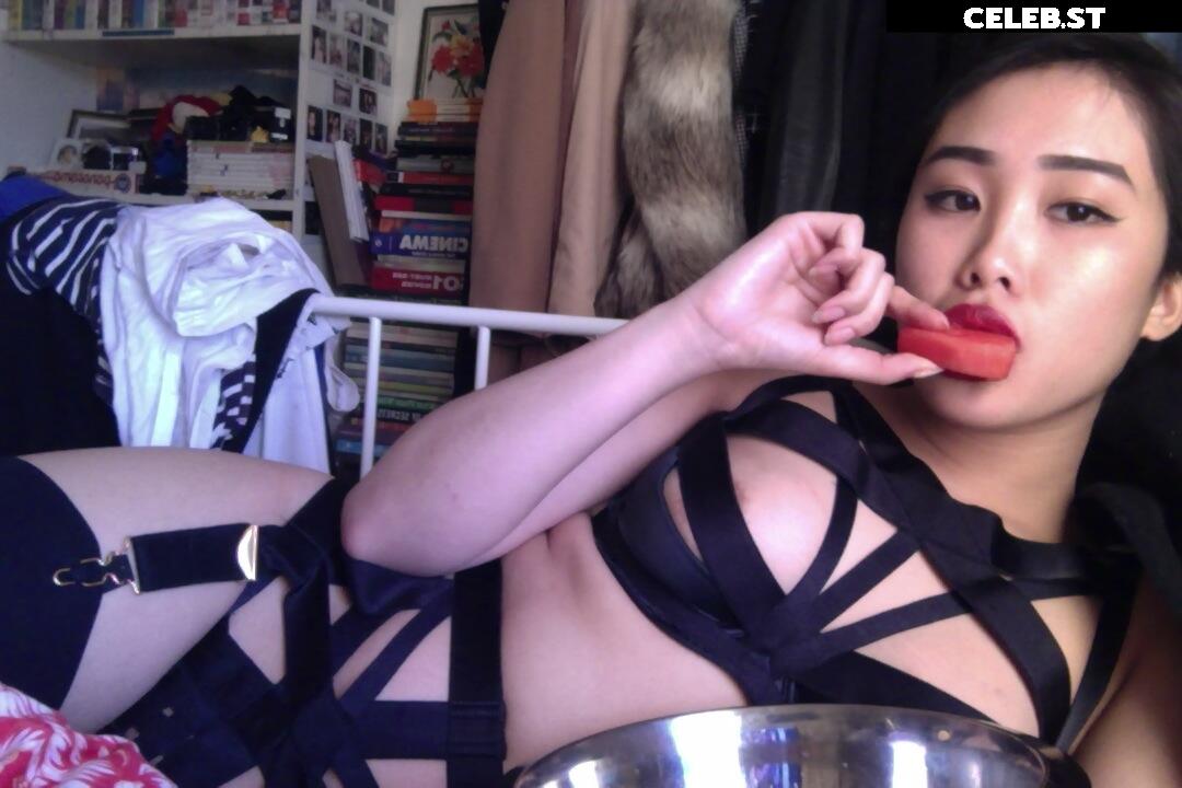 nickjonastillhasdiabetes Image 11993118