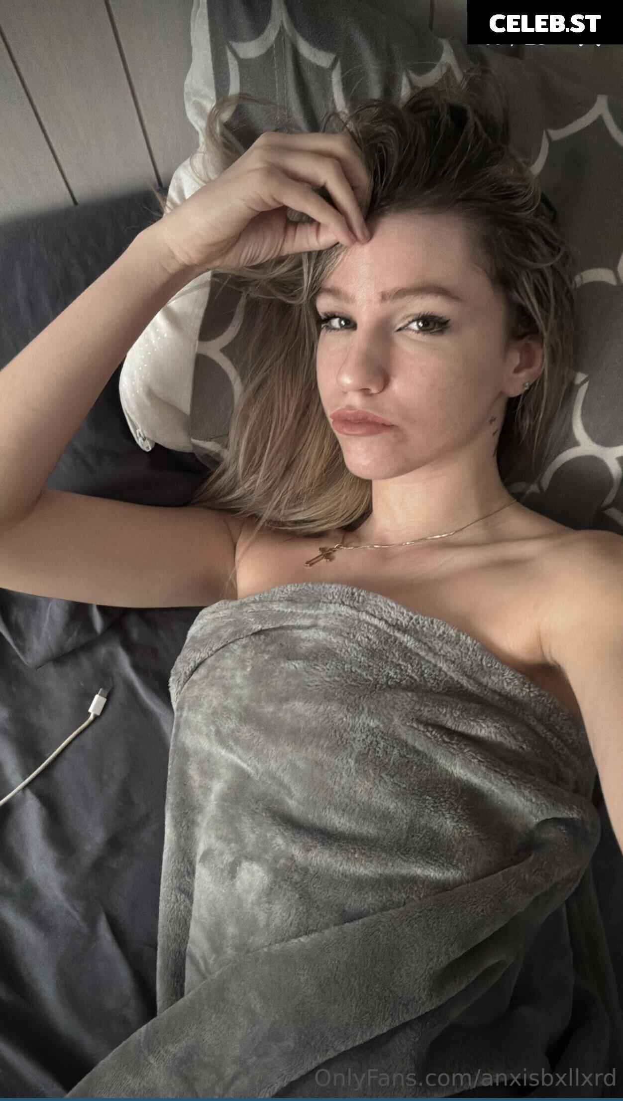 anxisbxllxrd Image 11862364