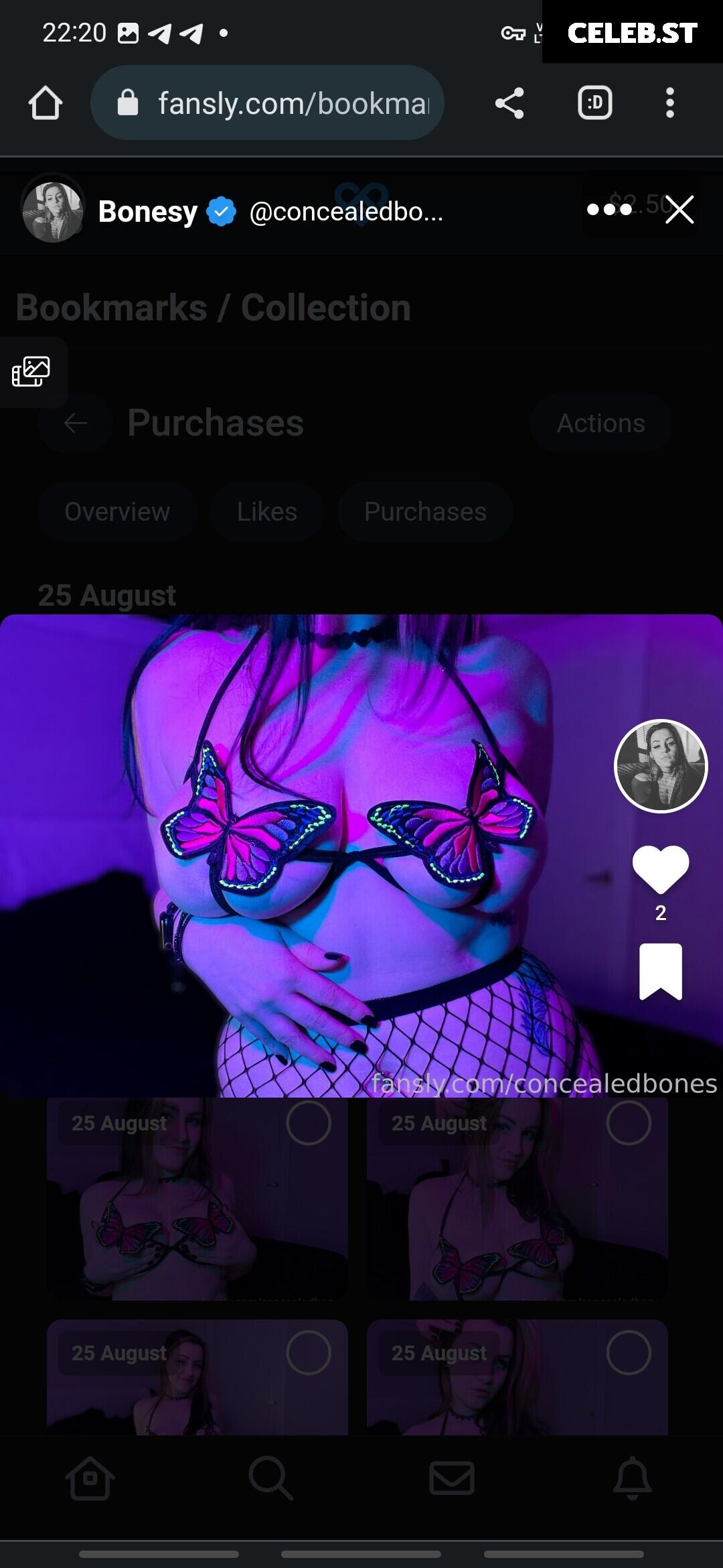 ConcealedBones Image 12418661