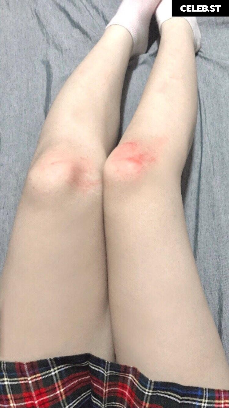 0ykurellaa Image 12155177