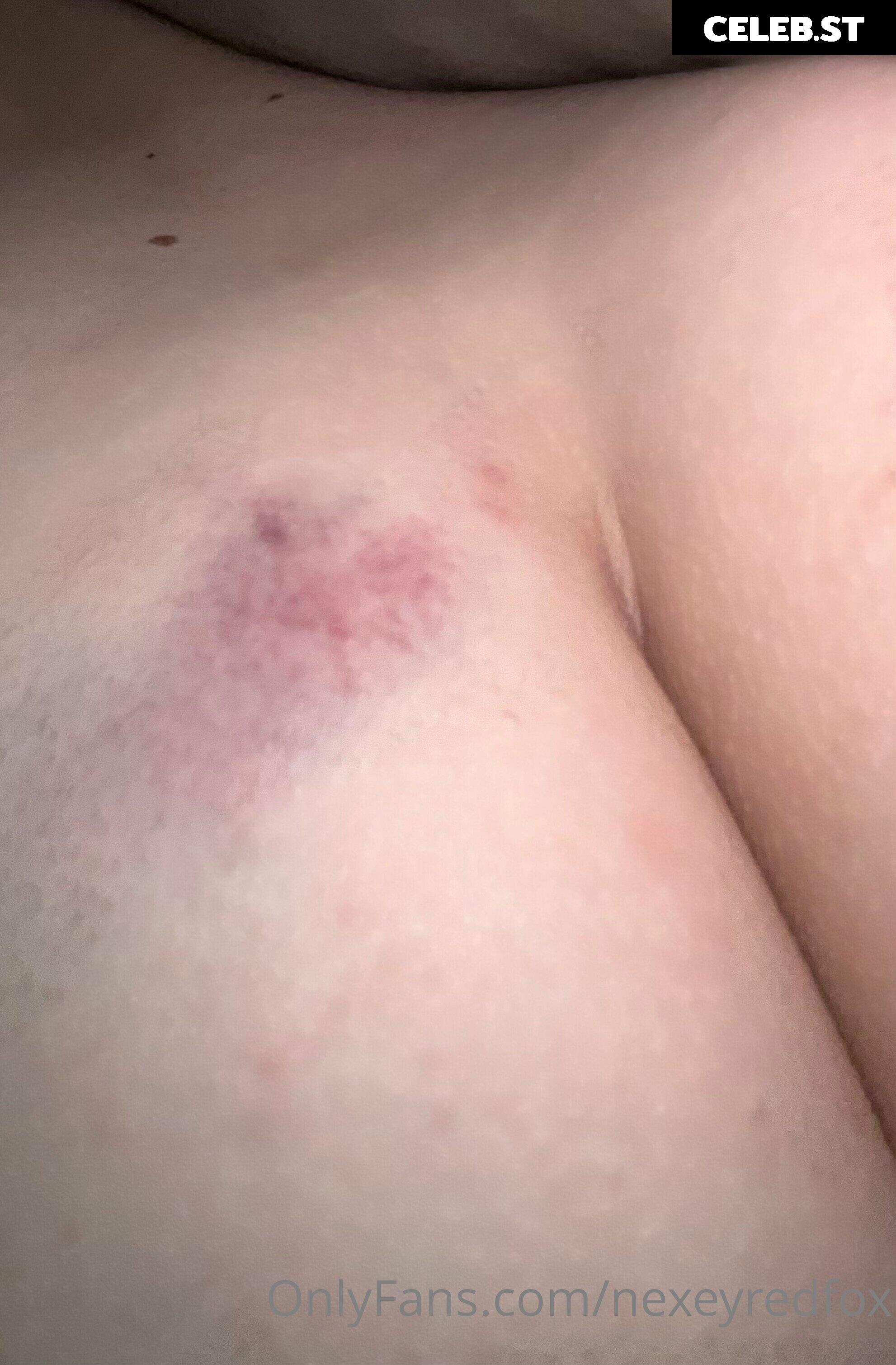 Nexeyredfox Image 192944