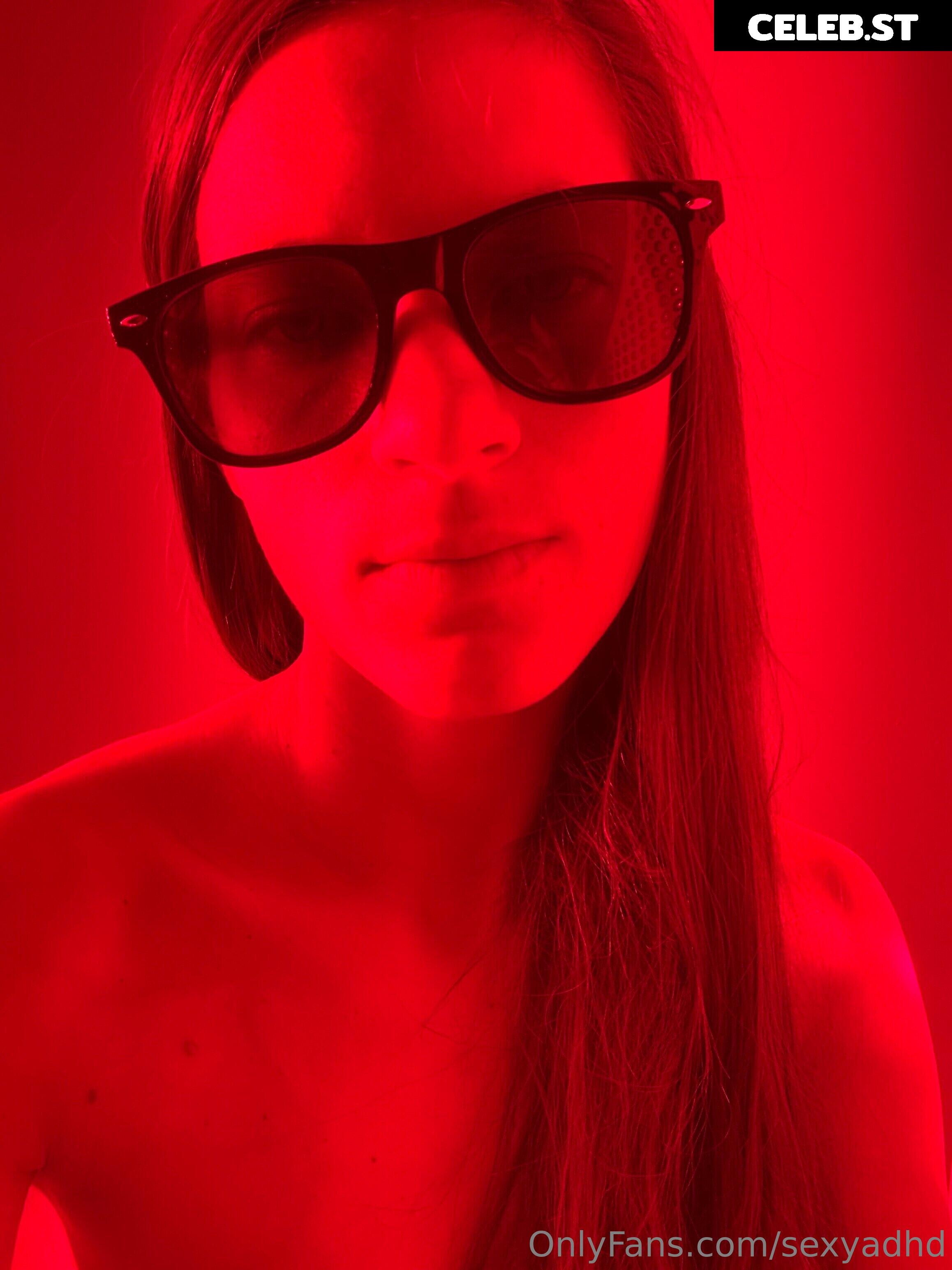 sexyadhd Image 14855572