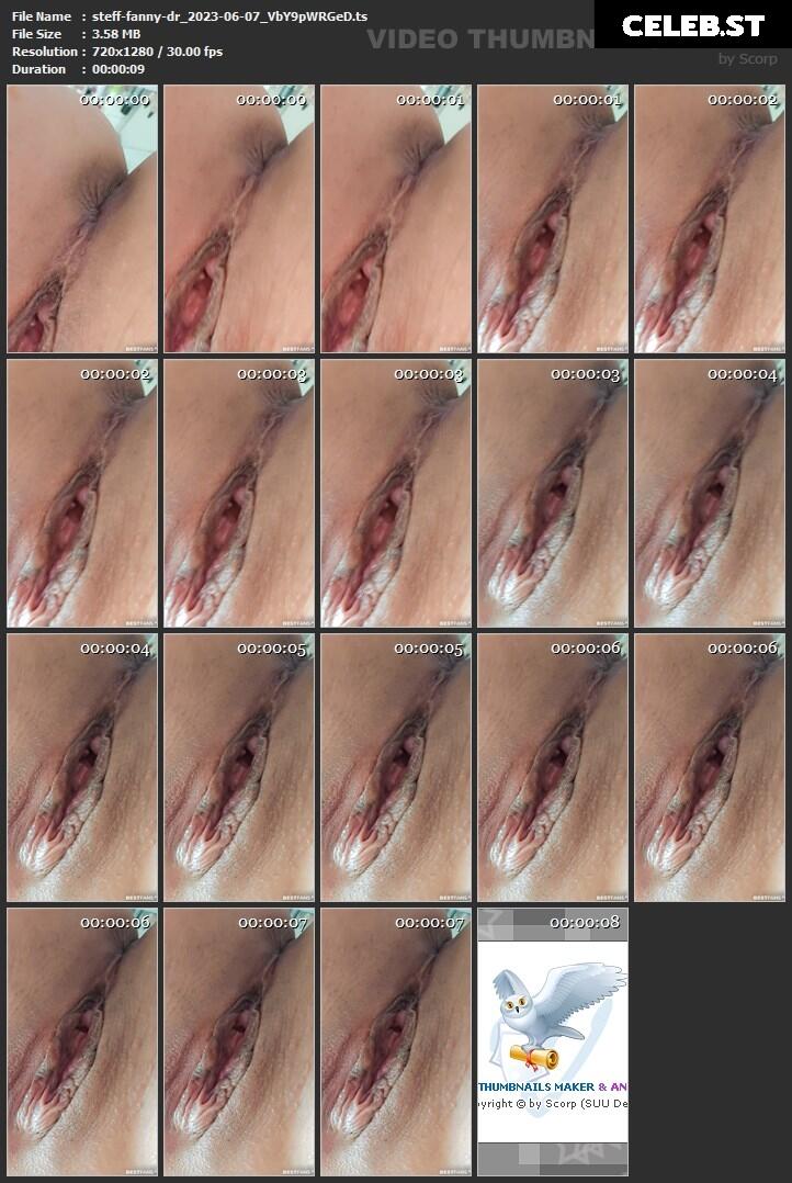 steff-fanny-dr Image 1662163