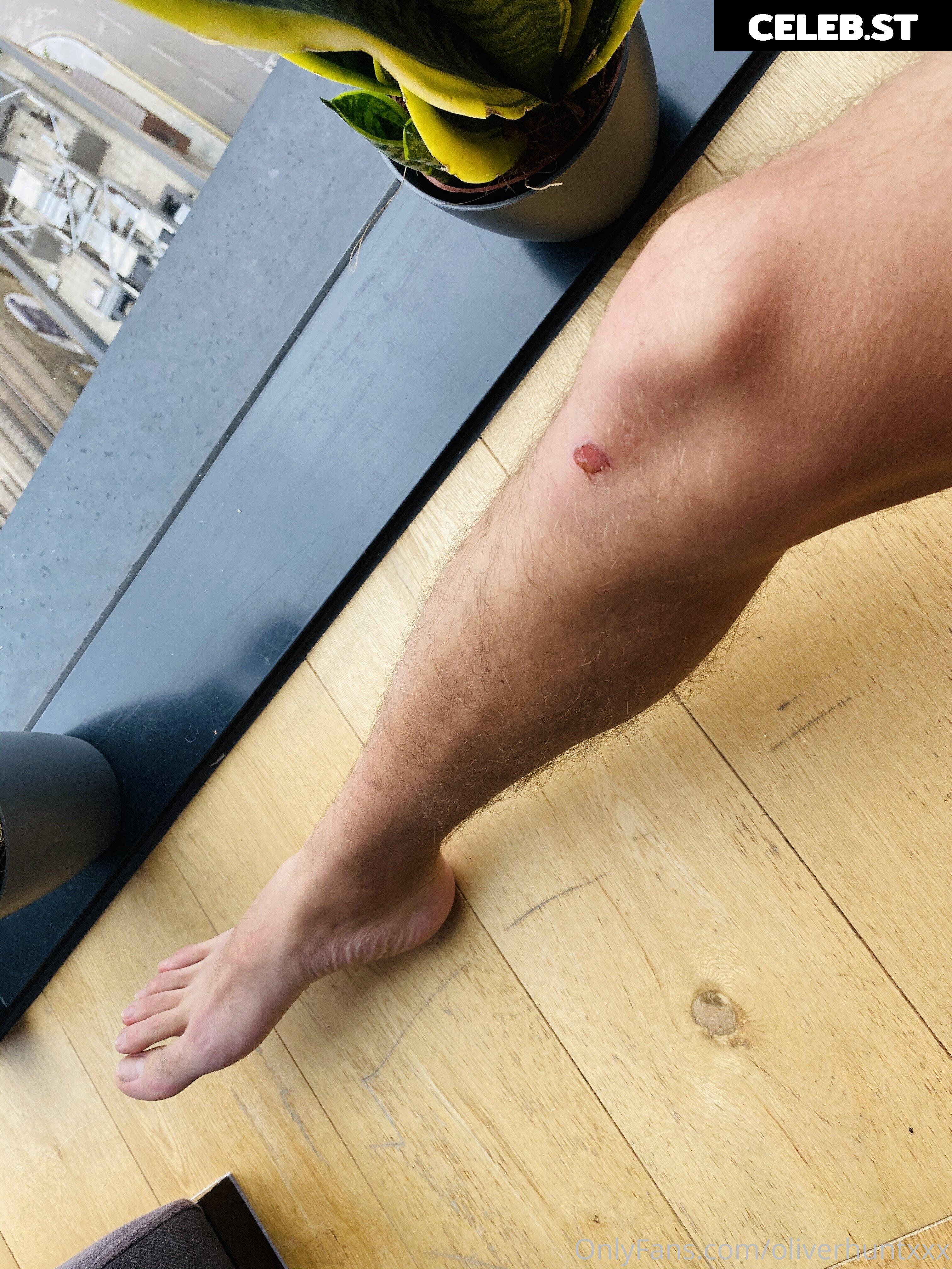oliverhuntxxx Image 17979215