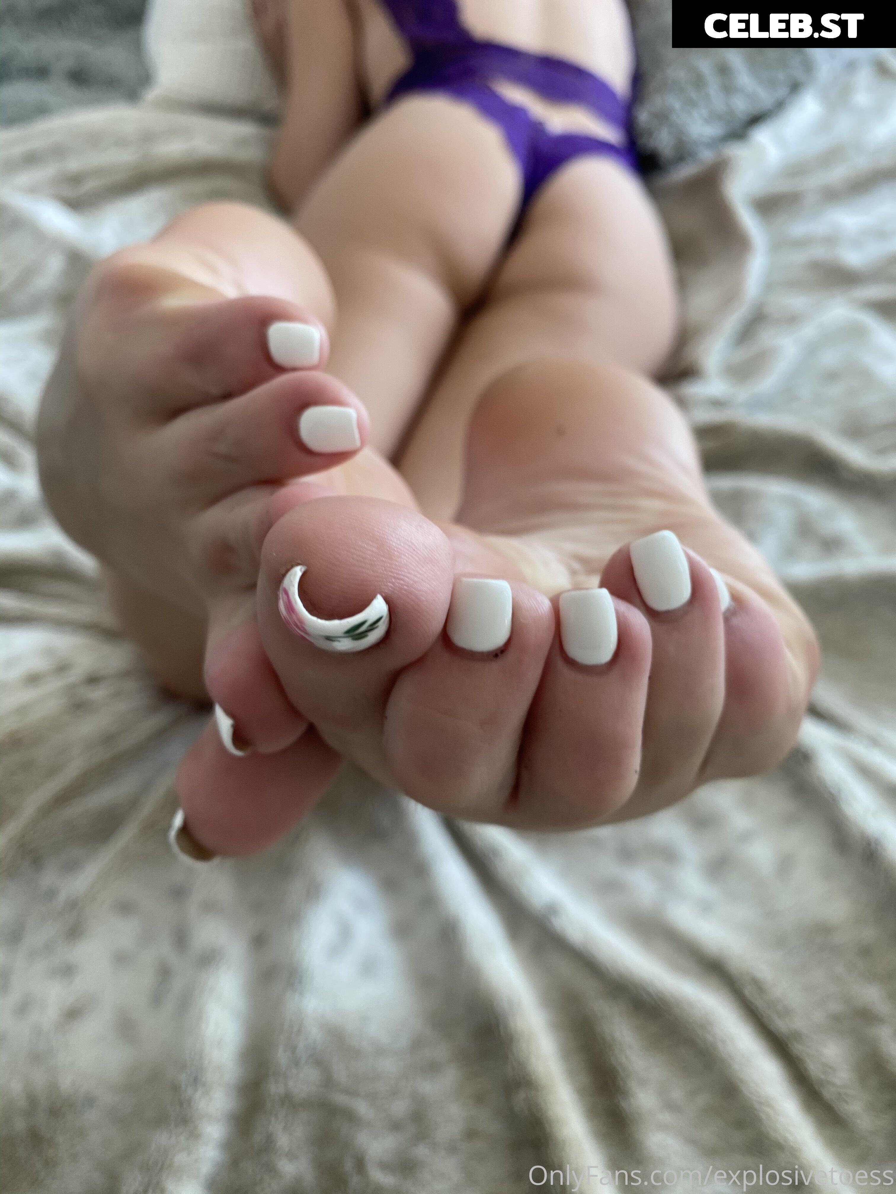explosivetoess Image 17758142