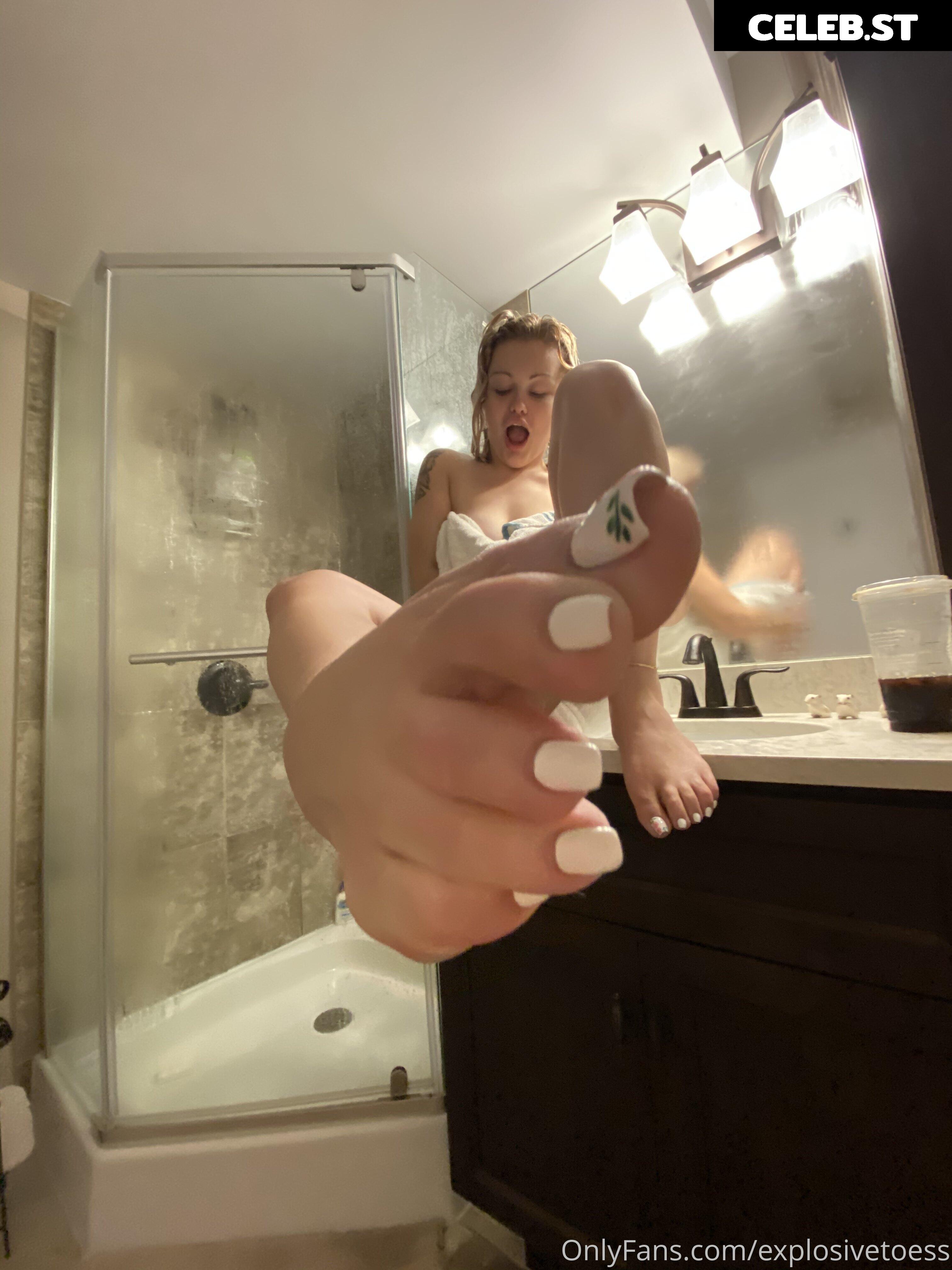 explosivetoess Image 17758006