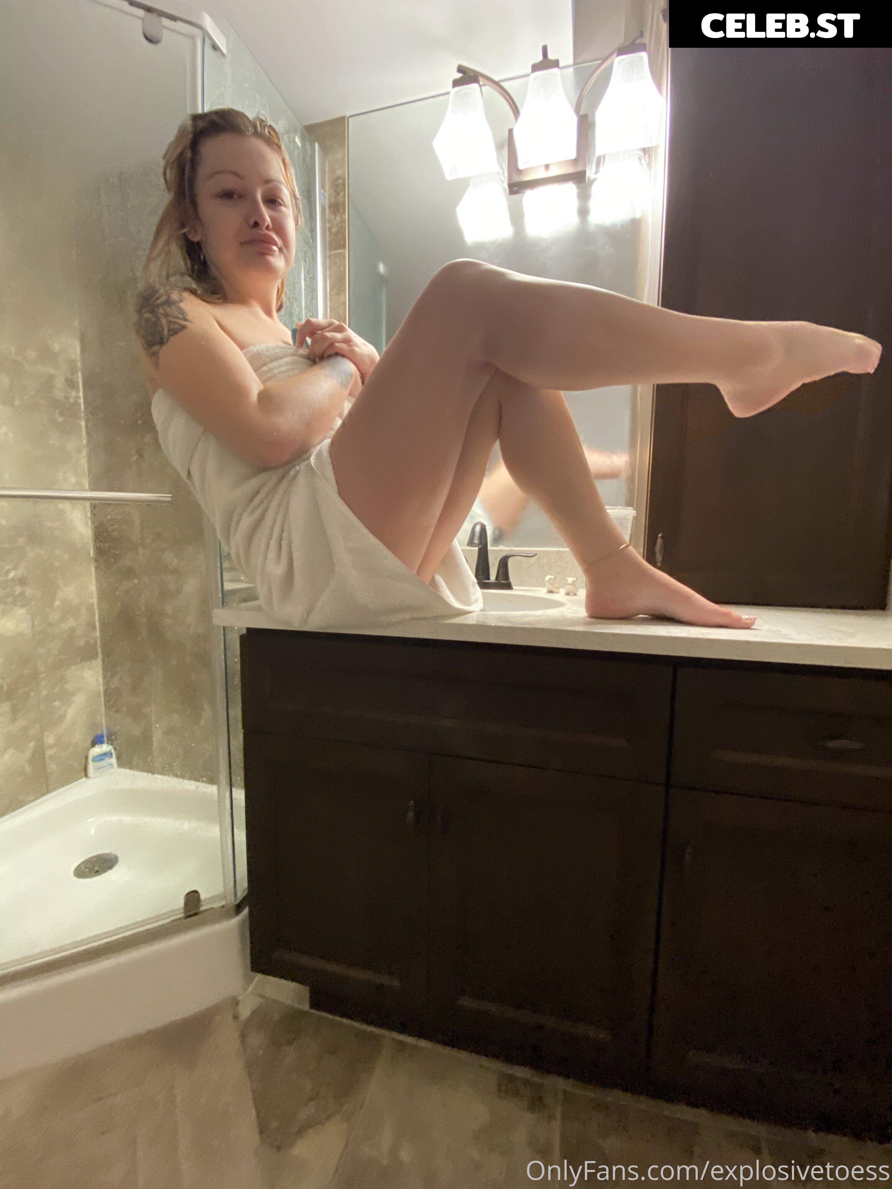 explosivetoess Image 17758047
