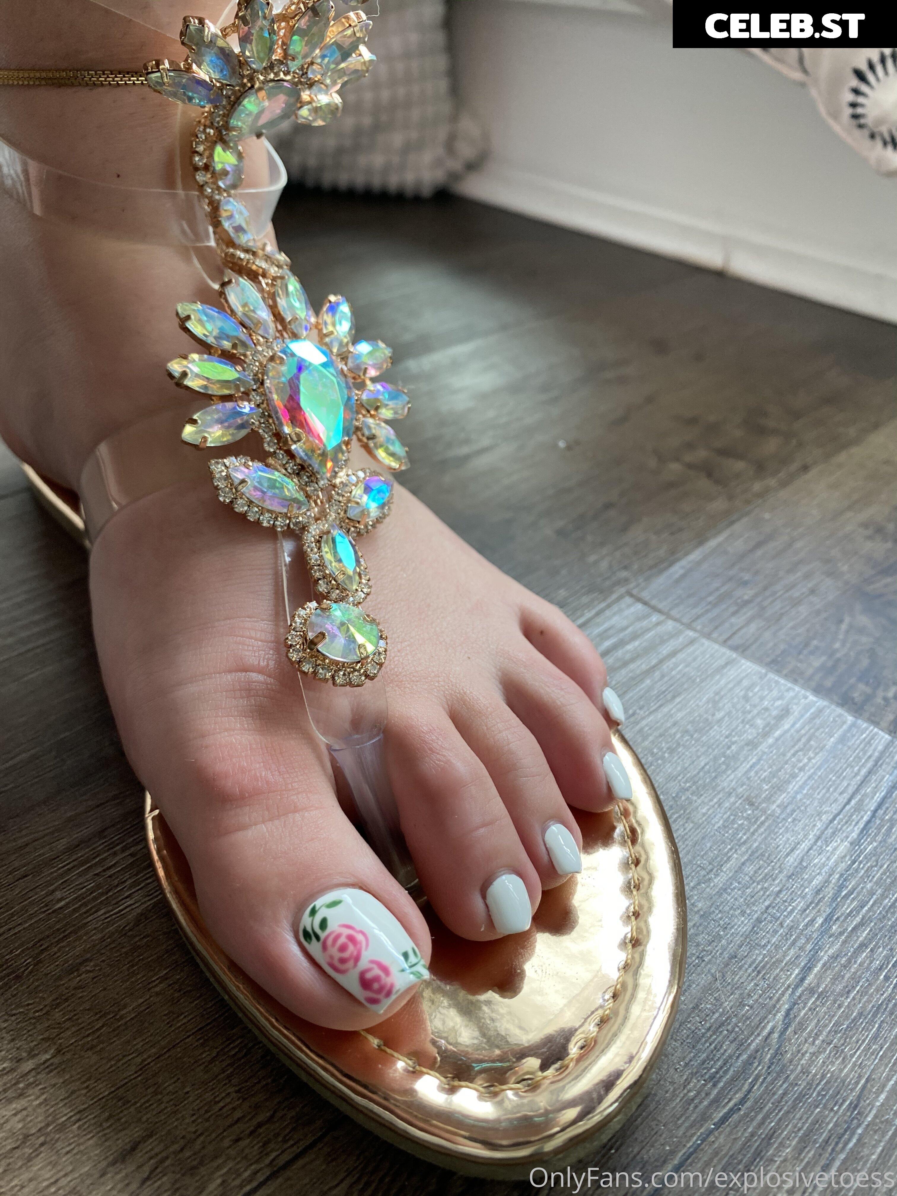 explosivetoess Image 17758255