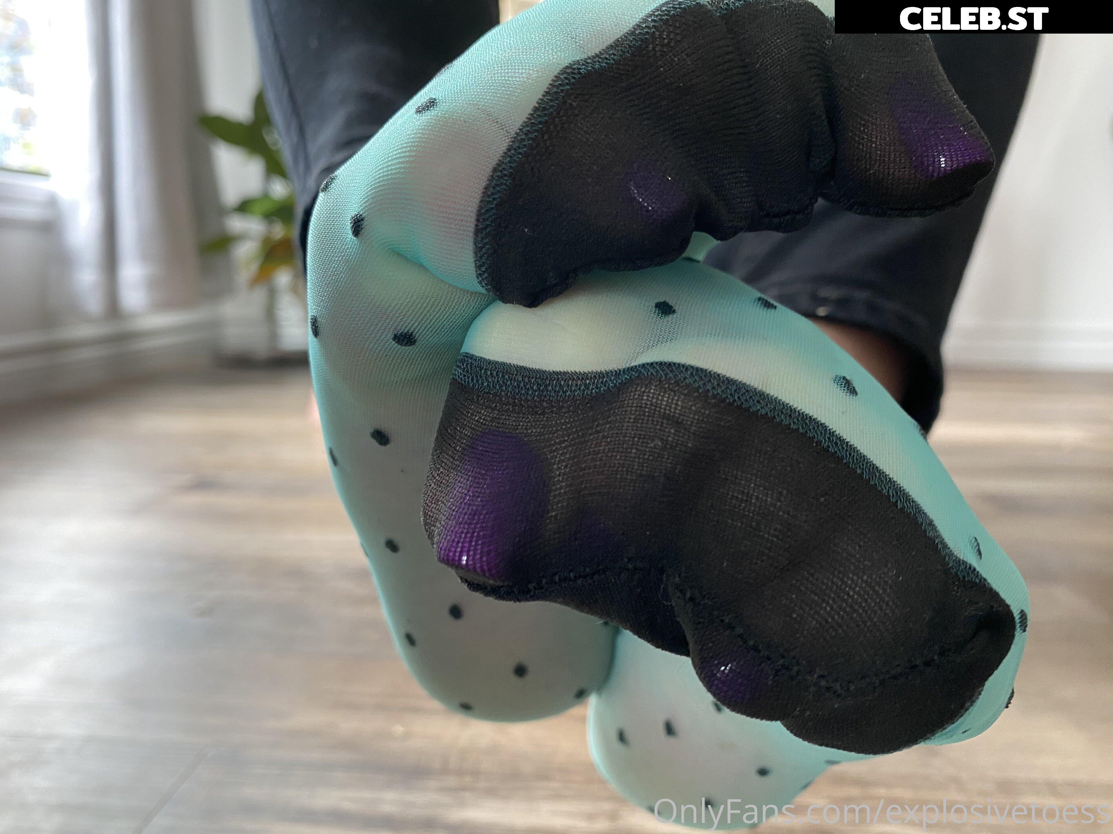 explosivetoess Image 17755894