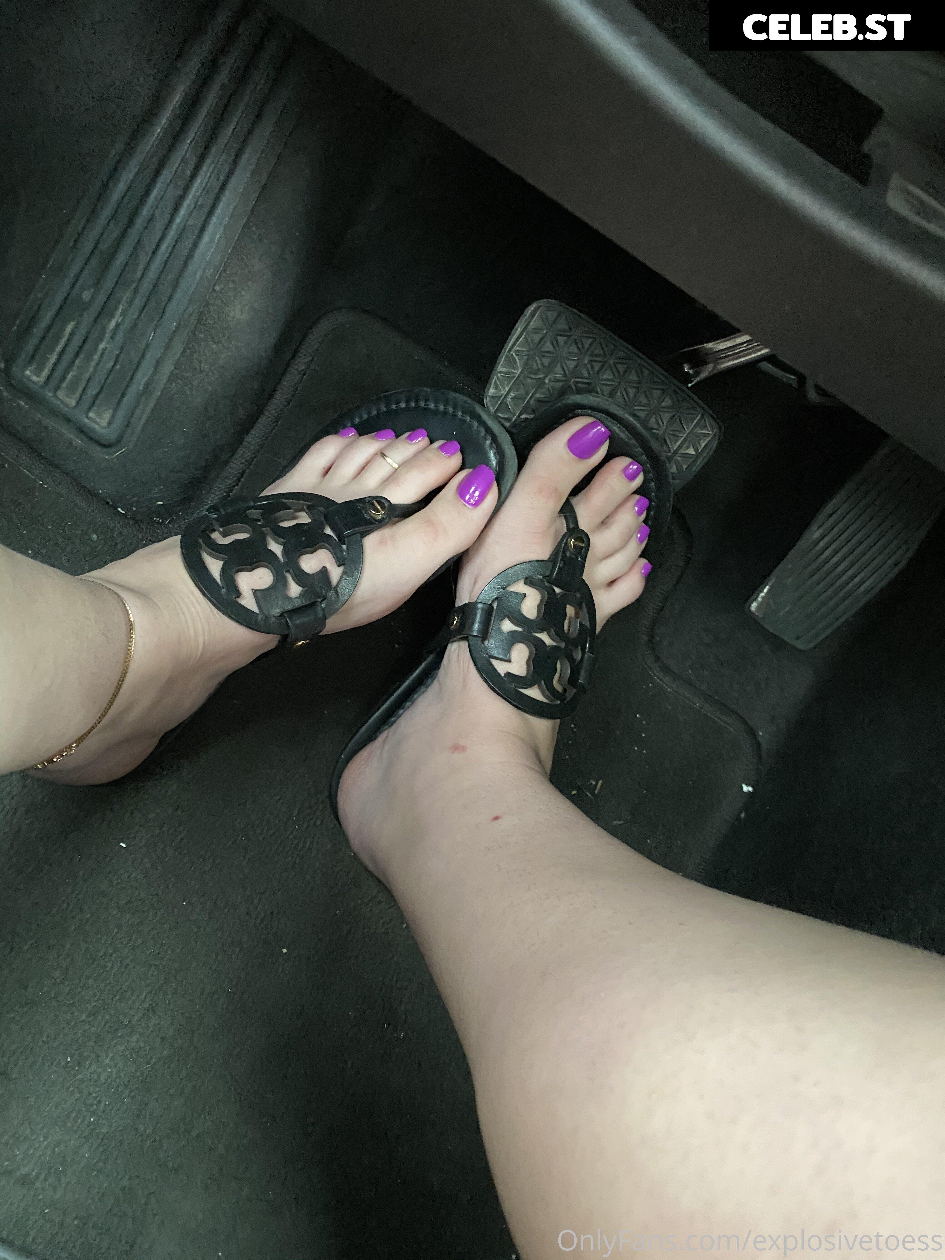 explosivetoess Image 17755703