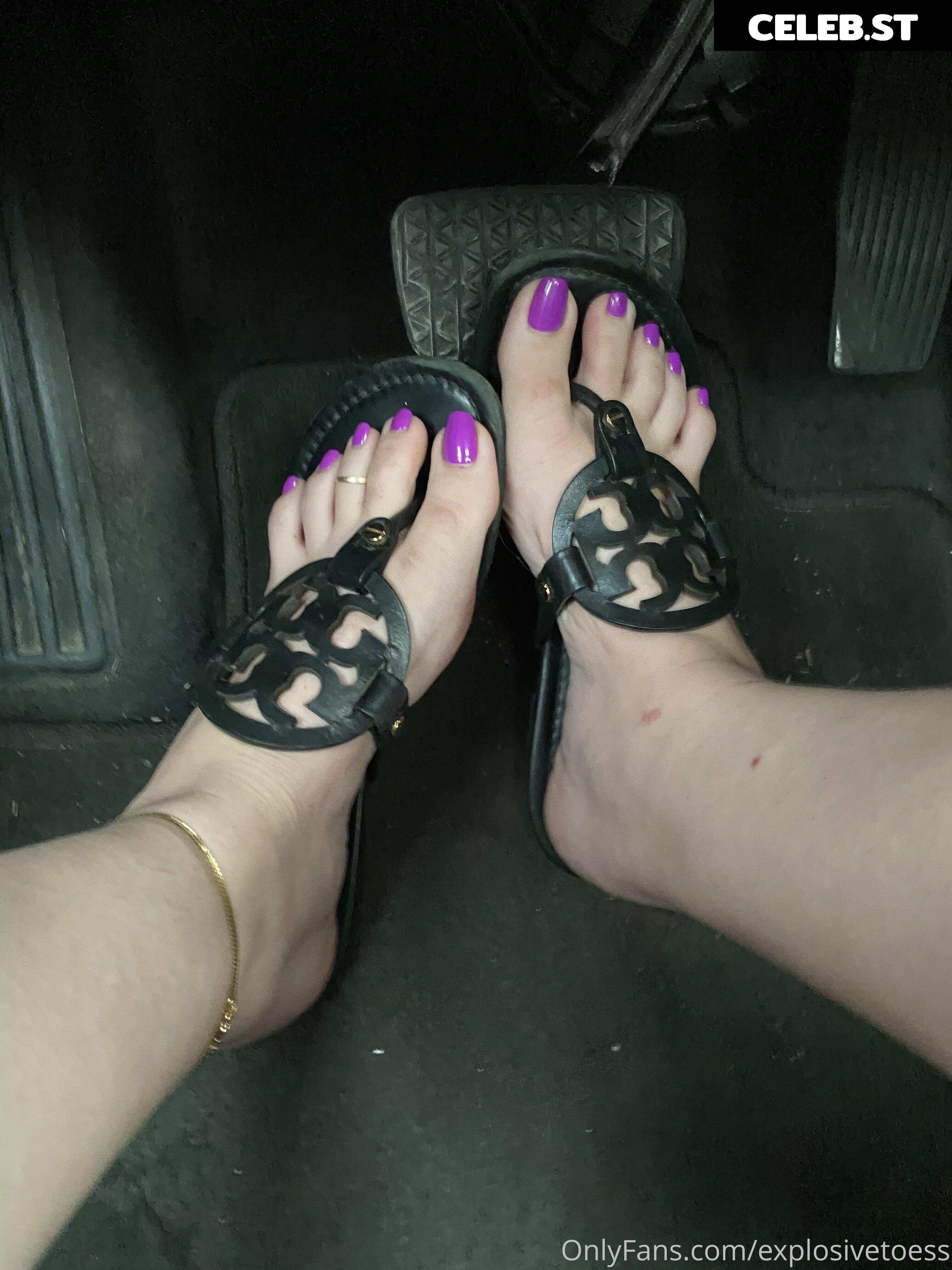 explosivetoess Image 17755602