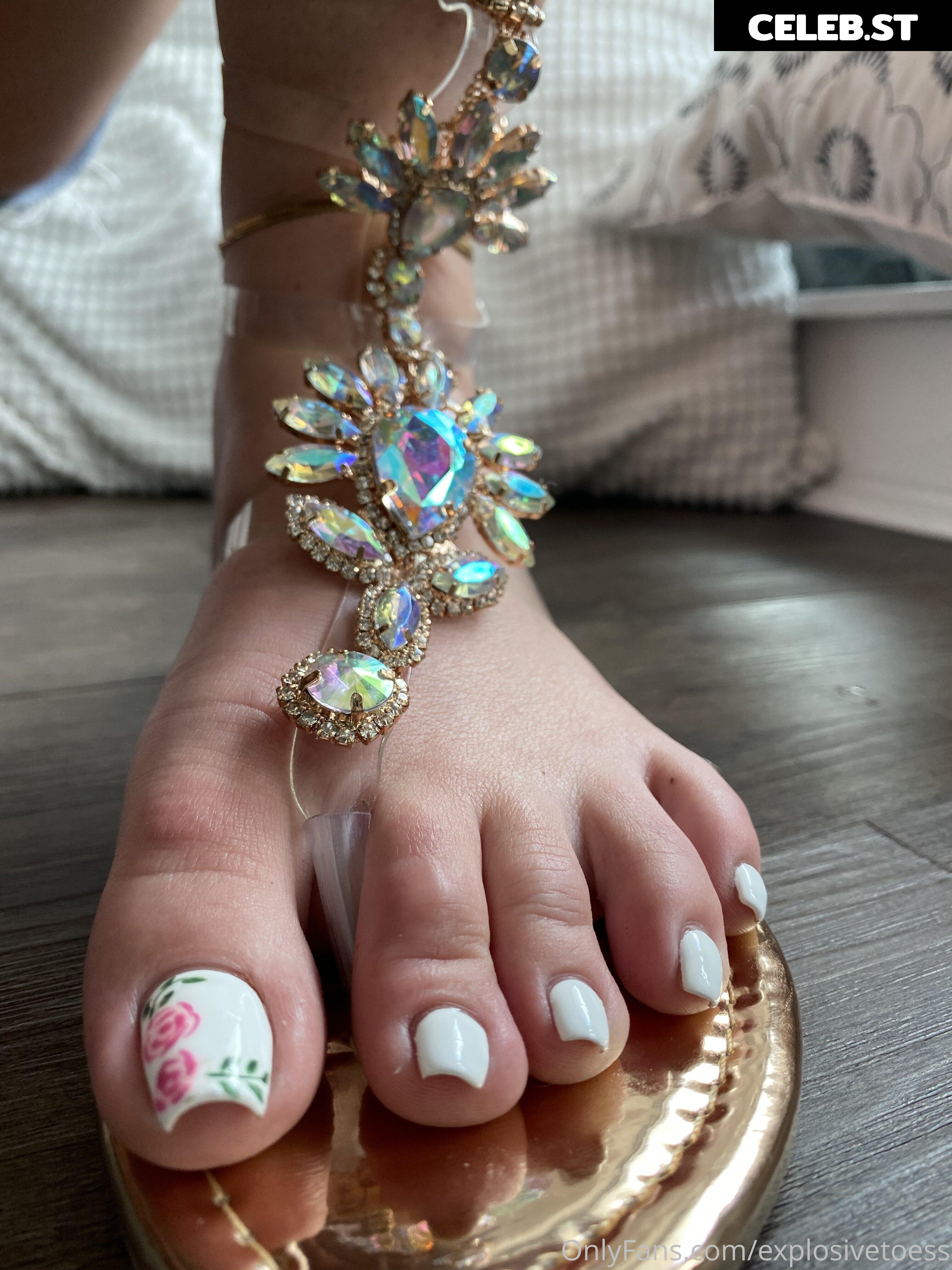 explosivetoess Image 17757945