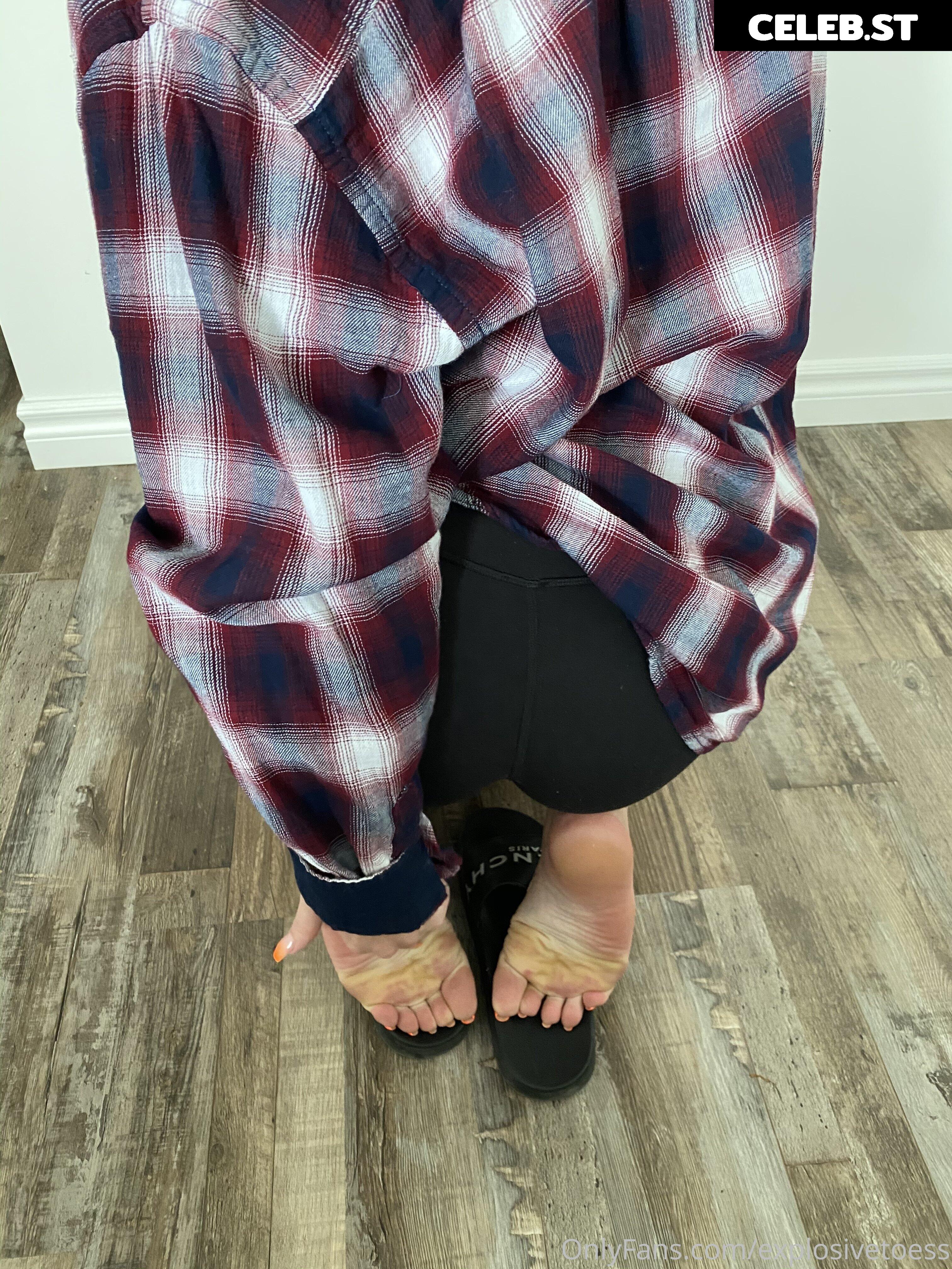 explosivetoess Image 17757782