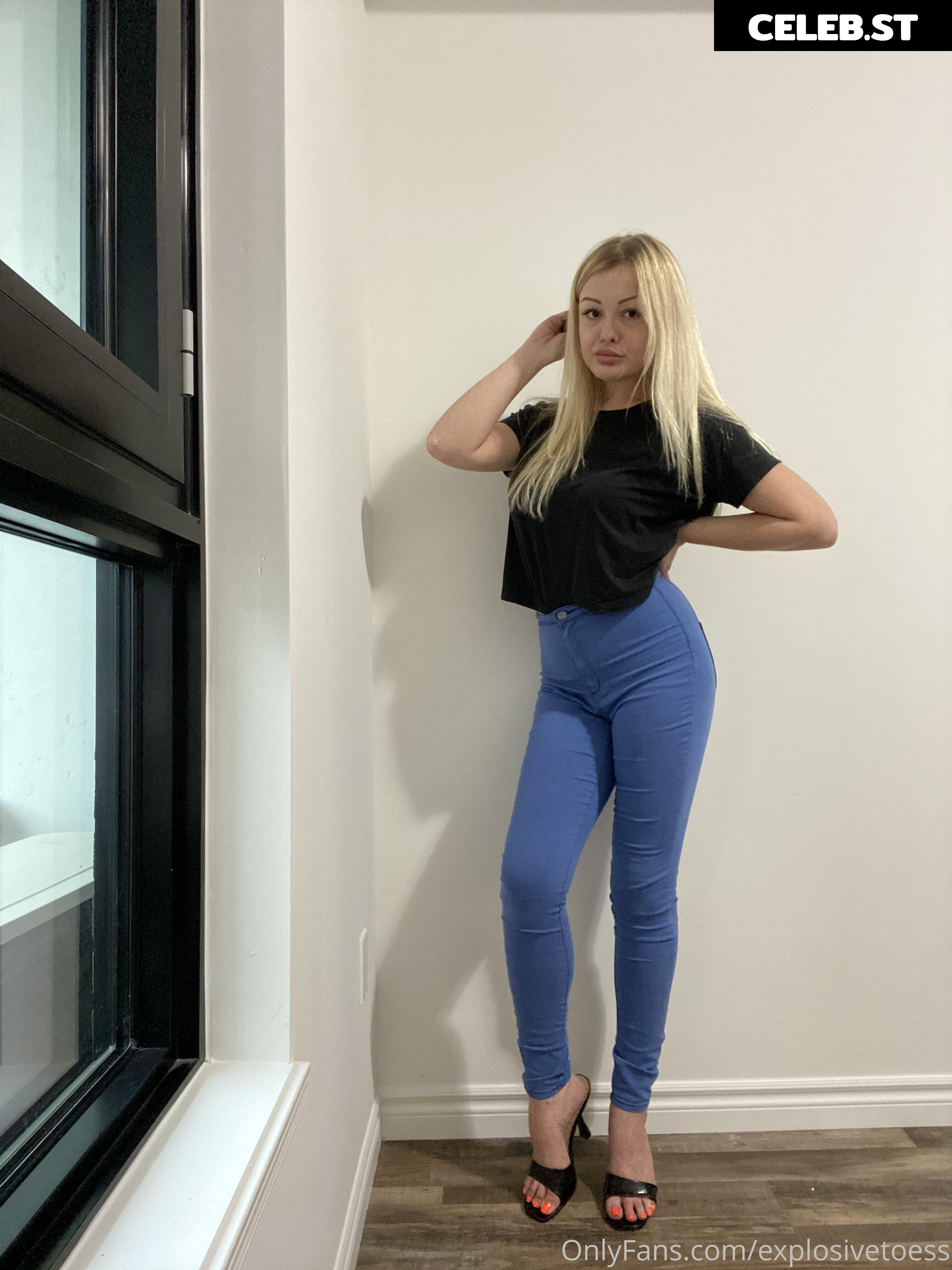 explosivetoess Image 17756163