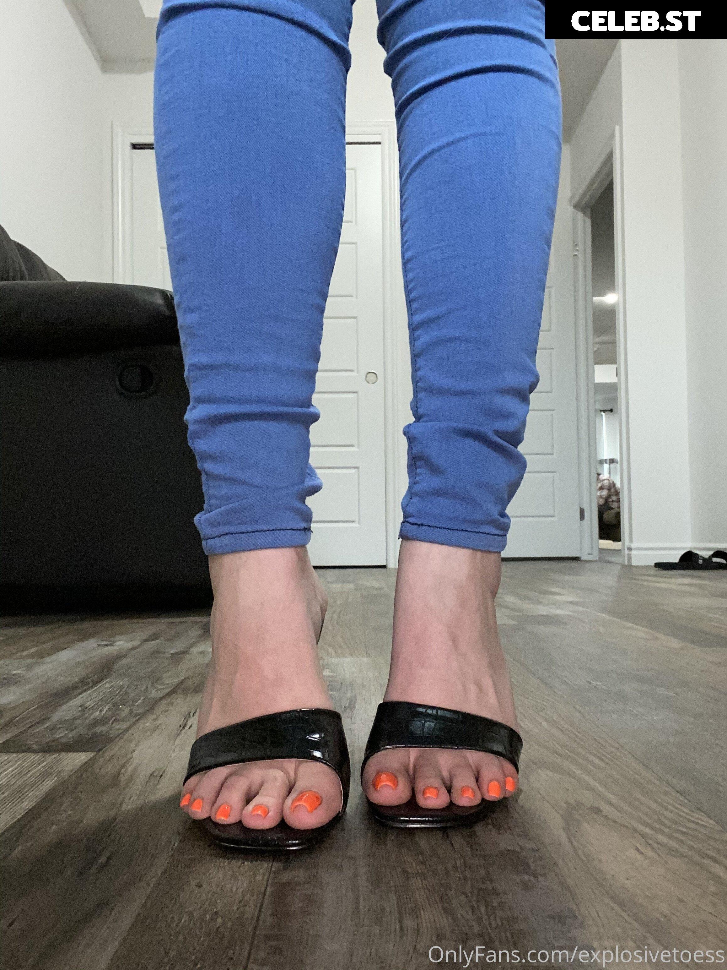explosivetoess Image 17756030
