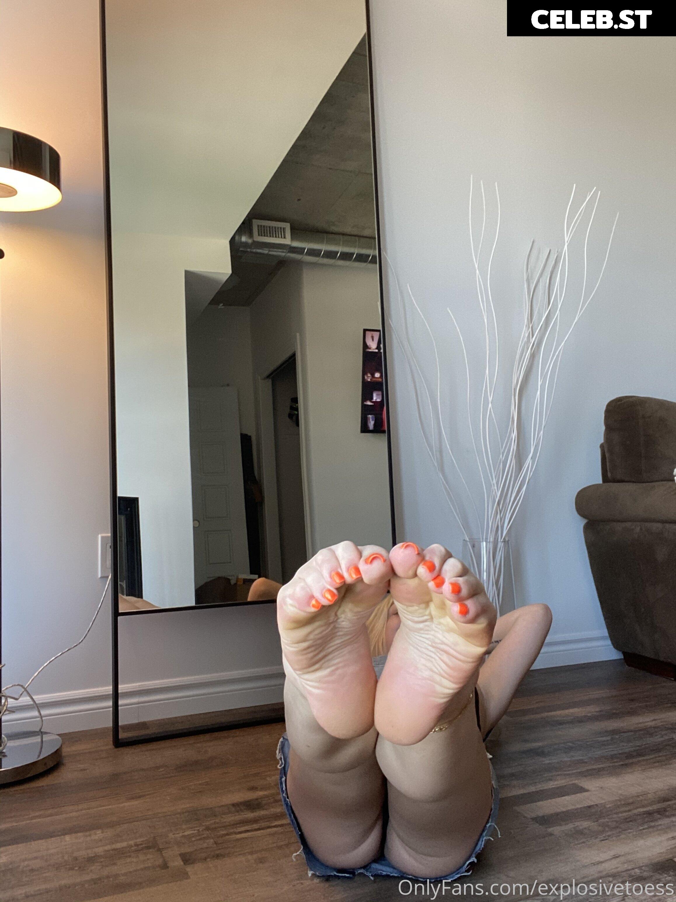 explosivetoess Image 17756046