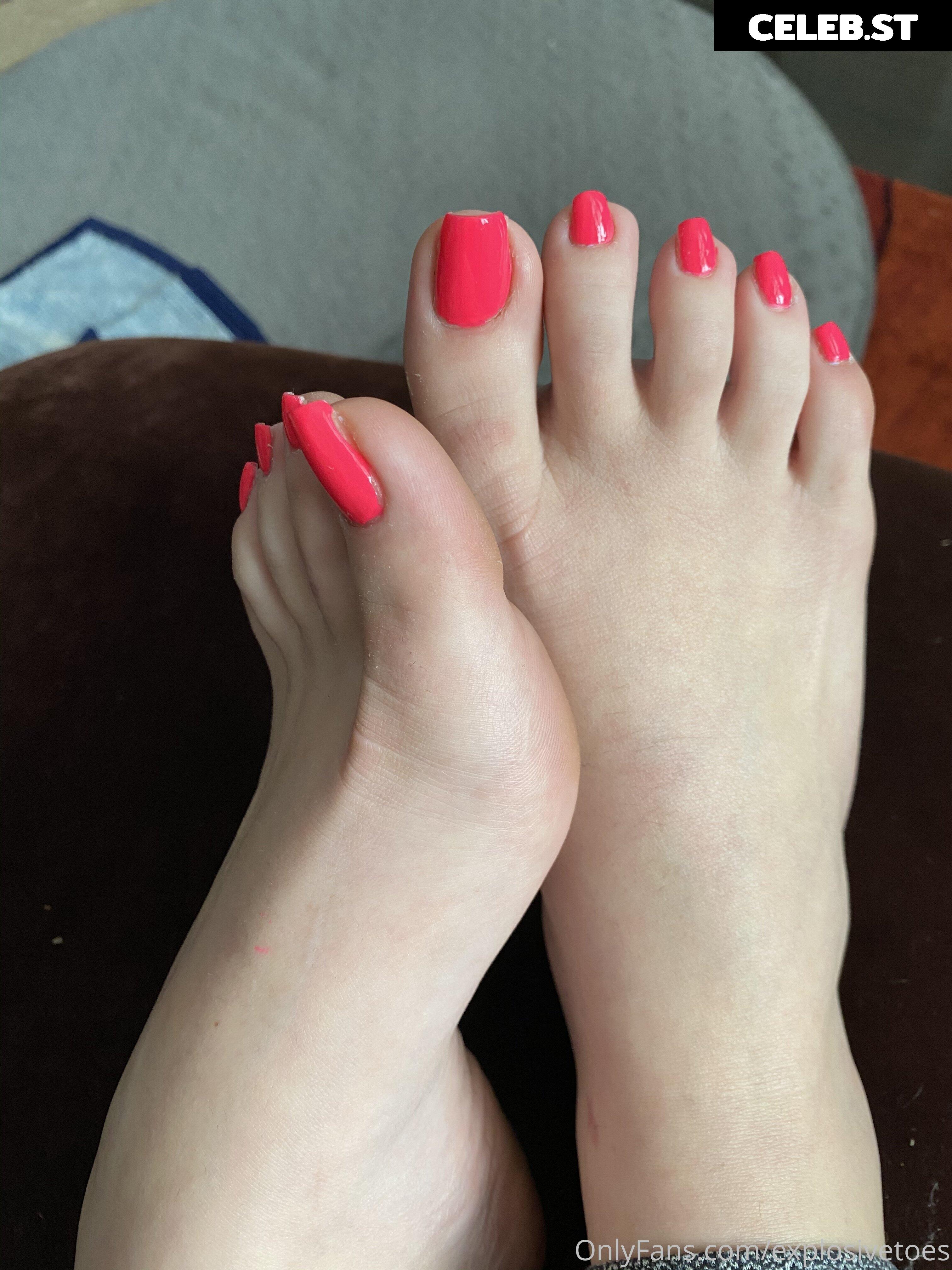 explosivetoess Image 17768560