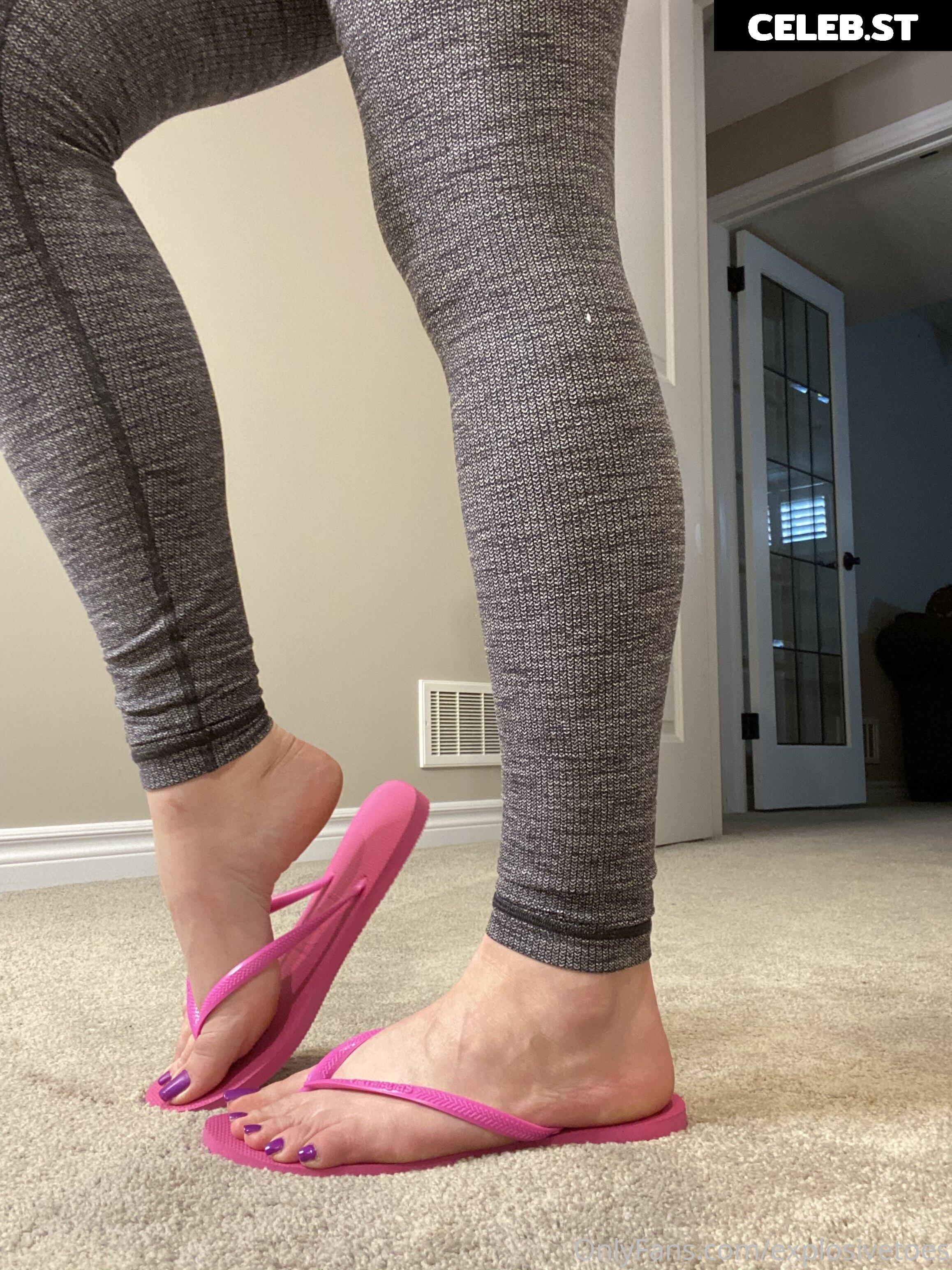explosivetoess Image 17768457
