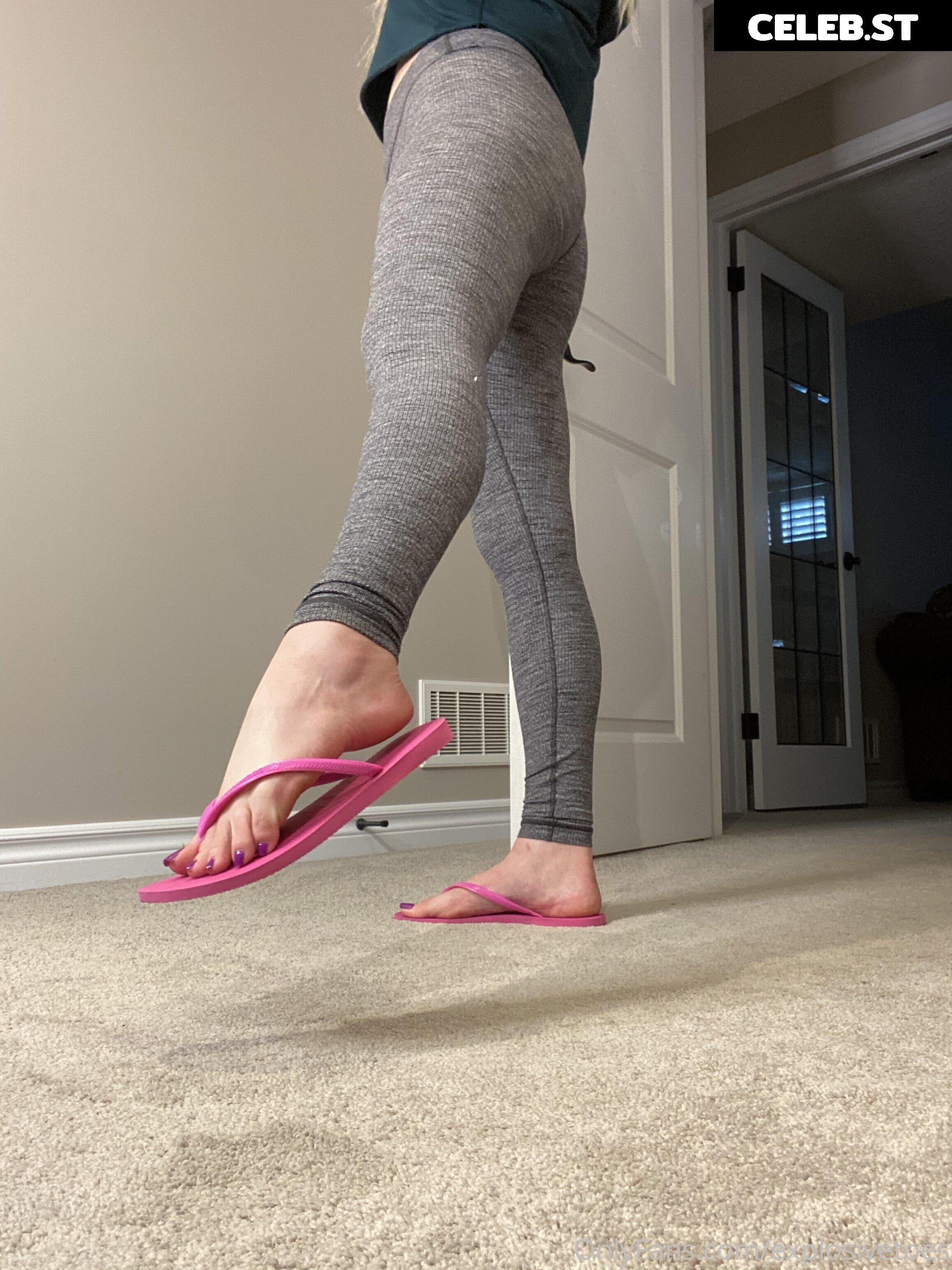 explosivetoess Image 17768192