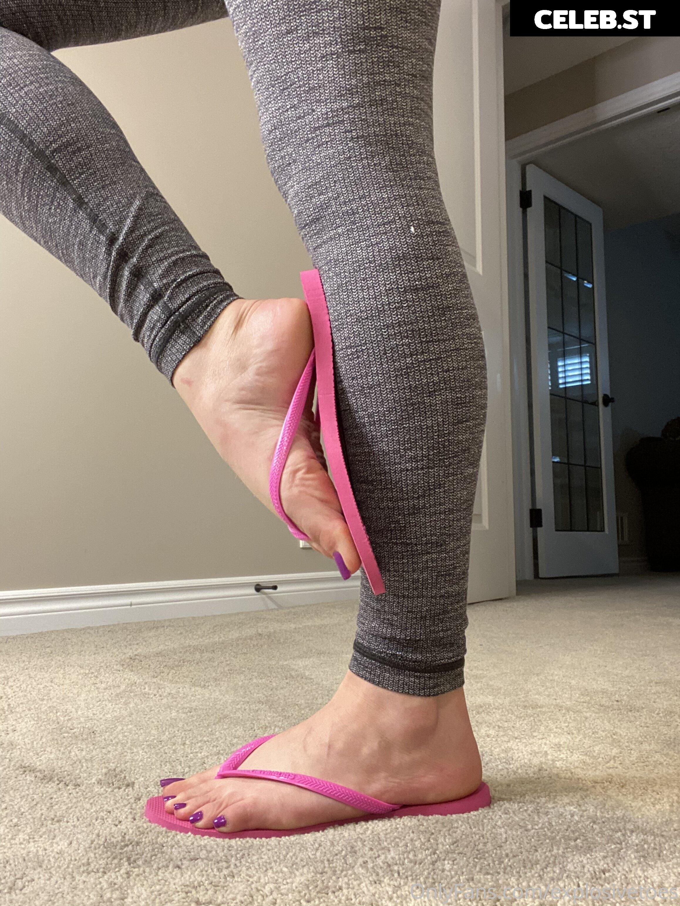 explosivetoess Image 17768122