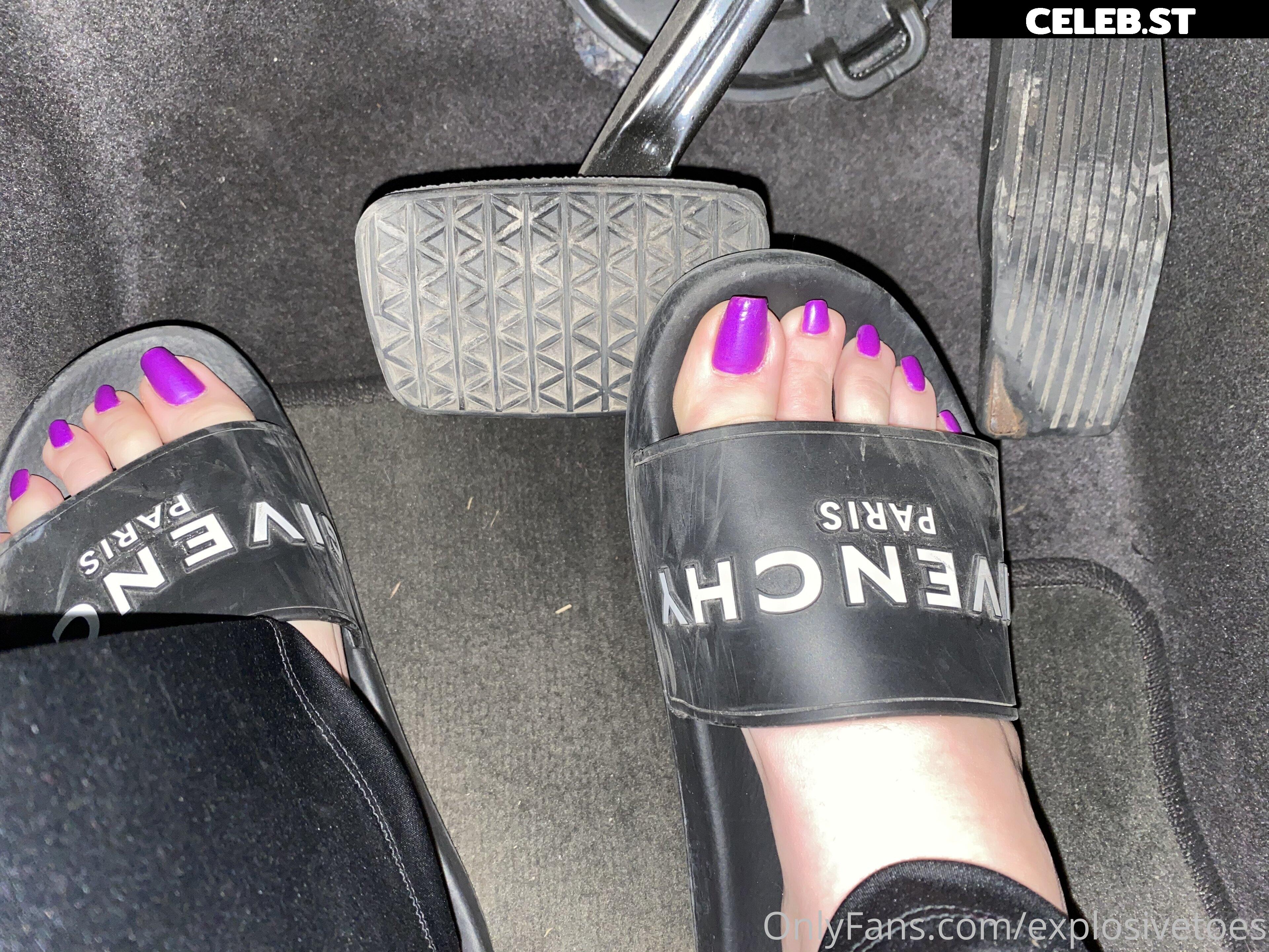 explosivetoess Image 17768132