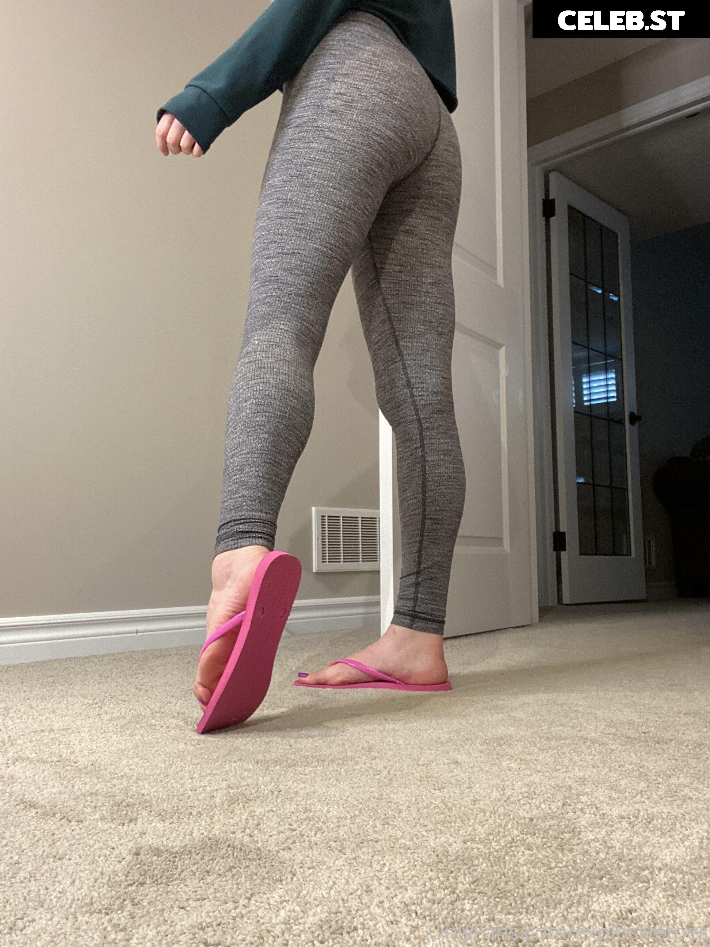 explosivetoess Image 17768140