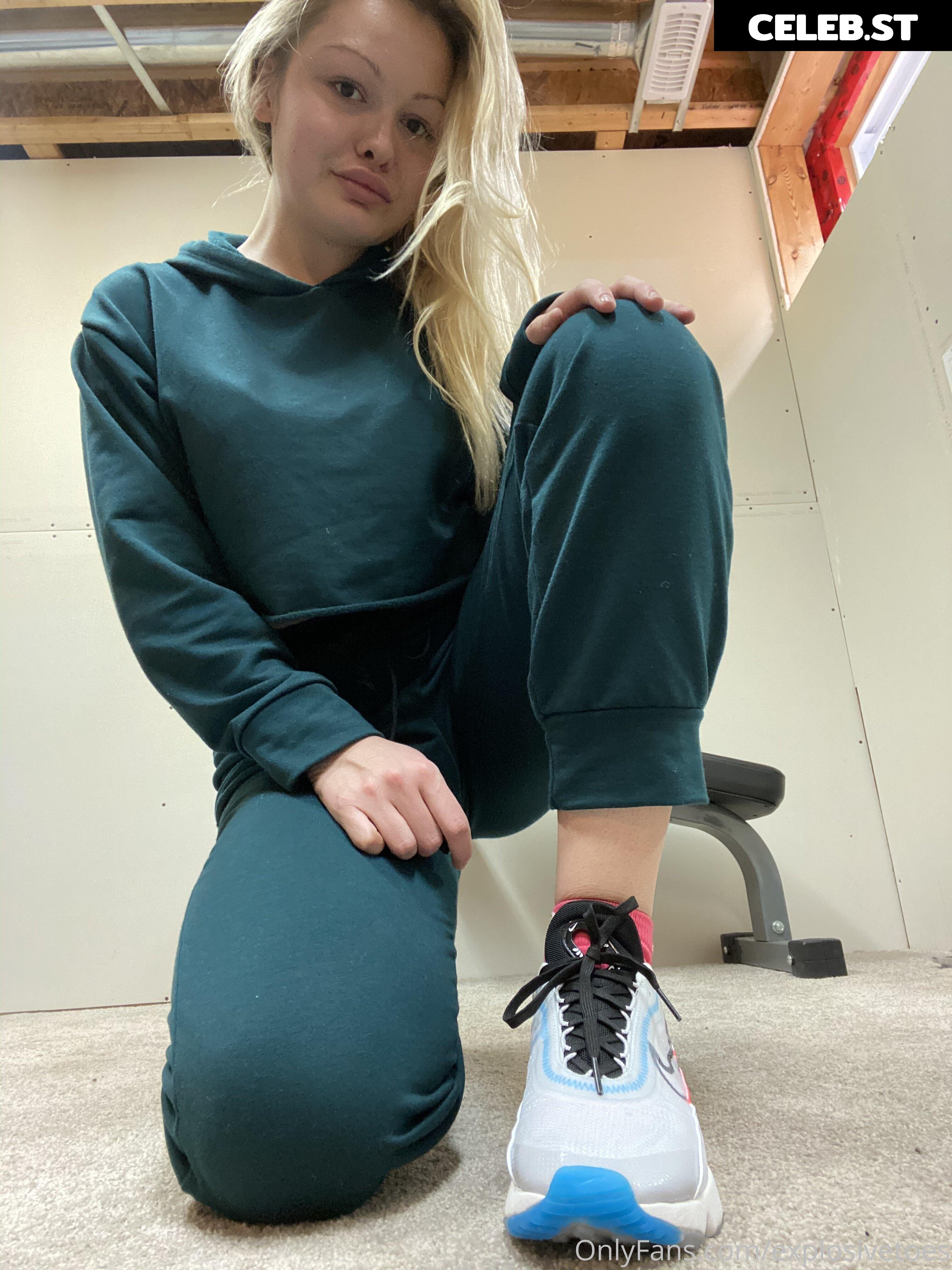 explosivetoess Image 17768148