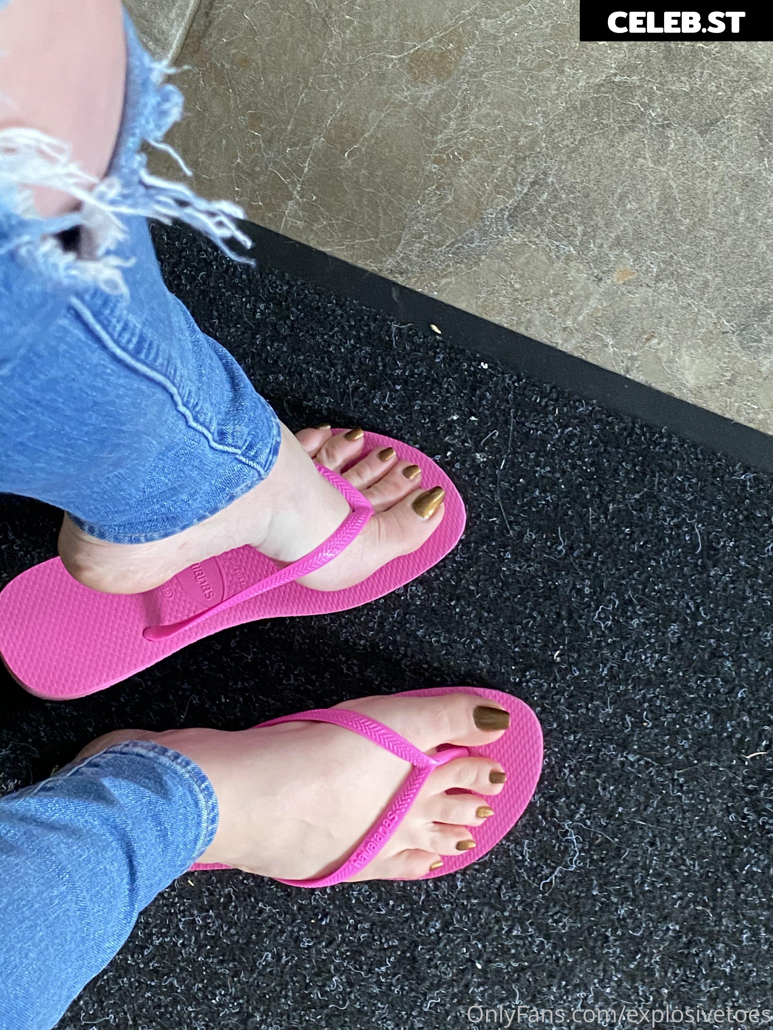 explosivetoess Image 17768063