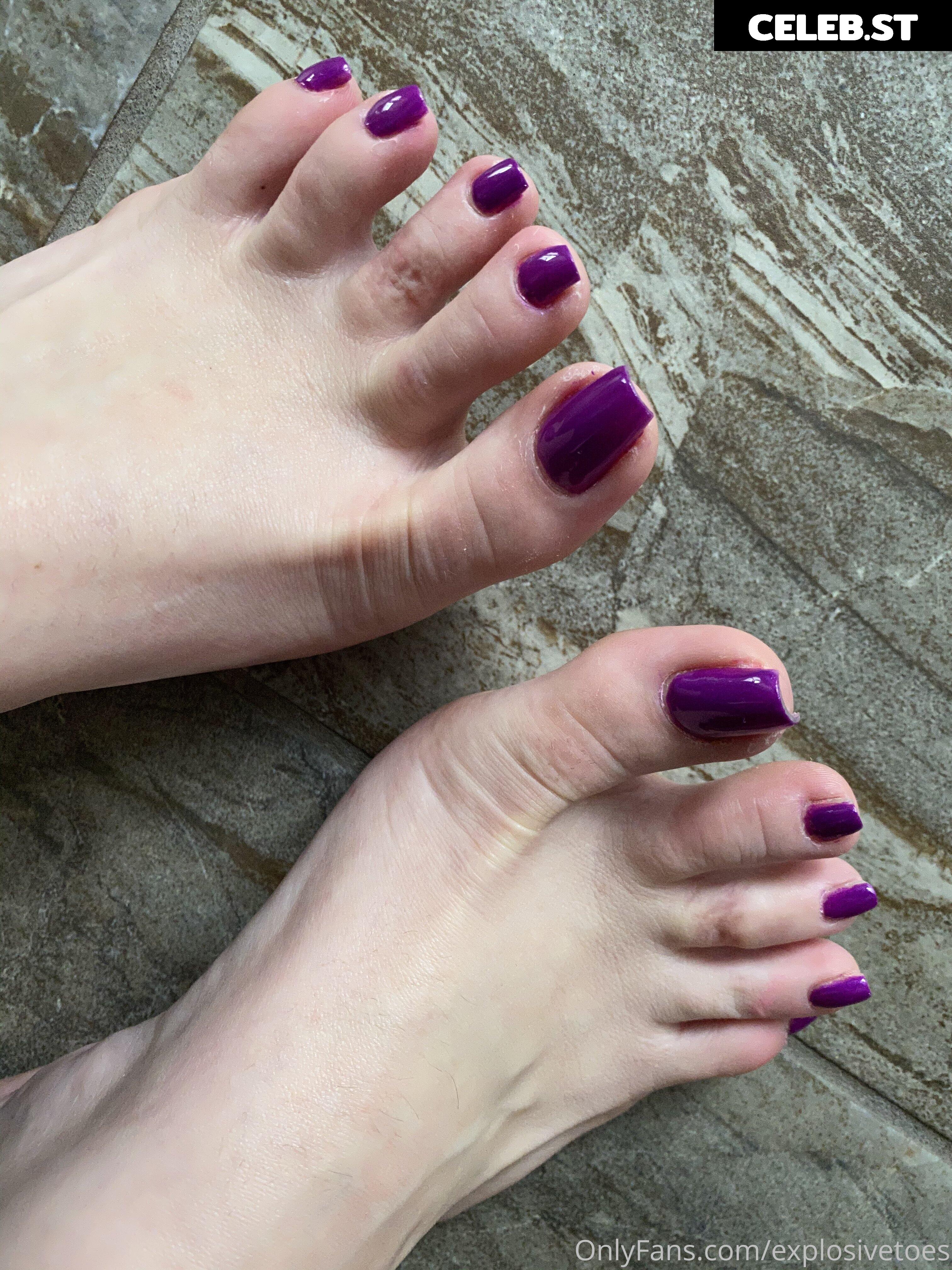 explosivetoess Image 17768360