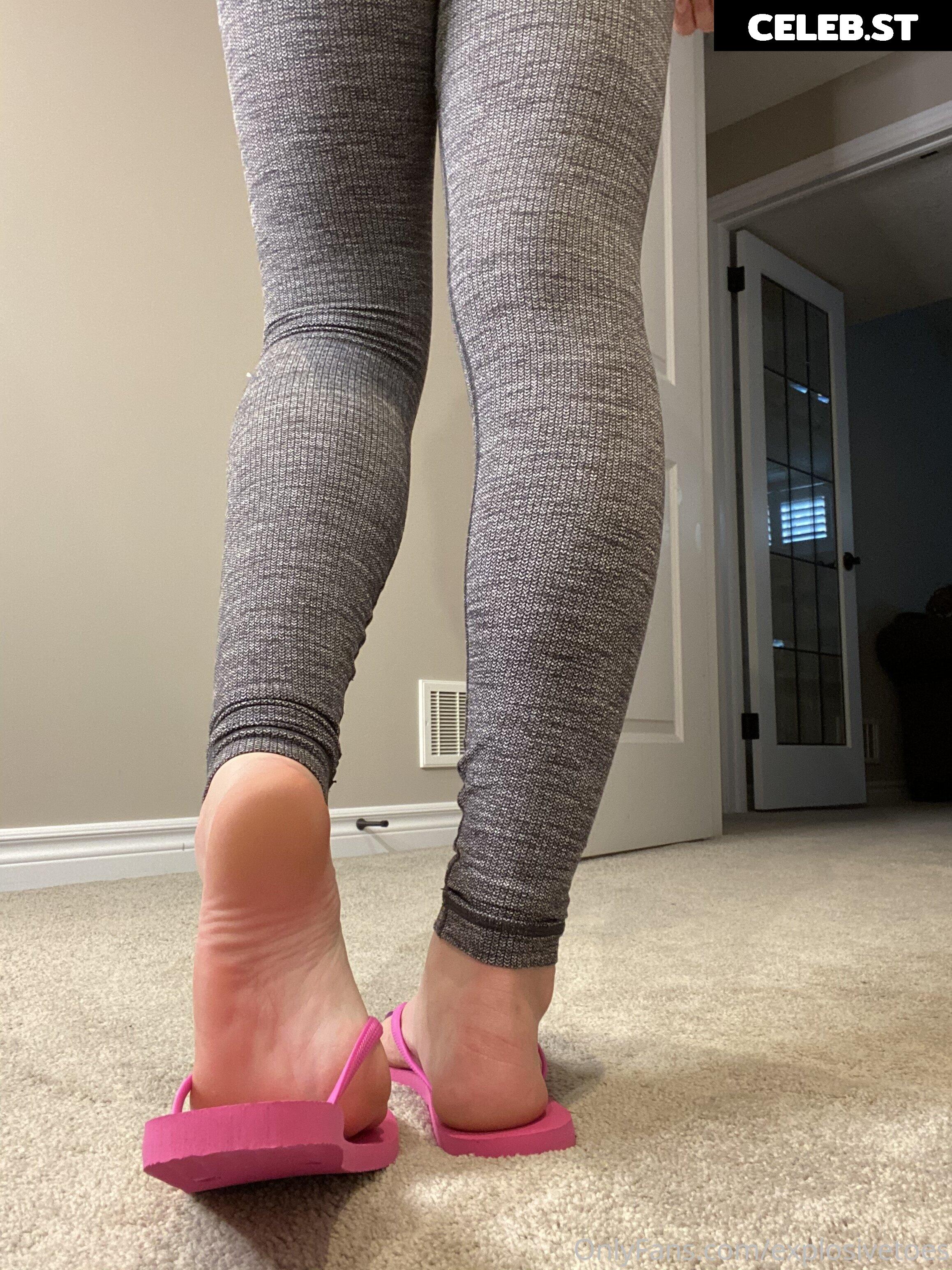 explosivetoess Image 17768364