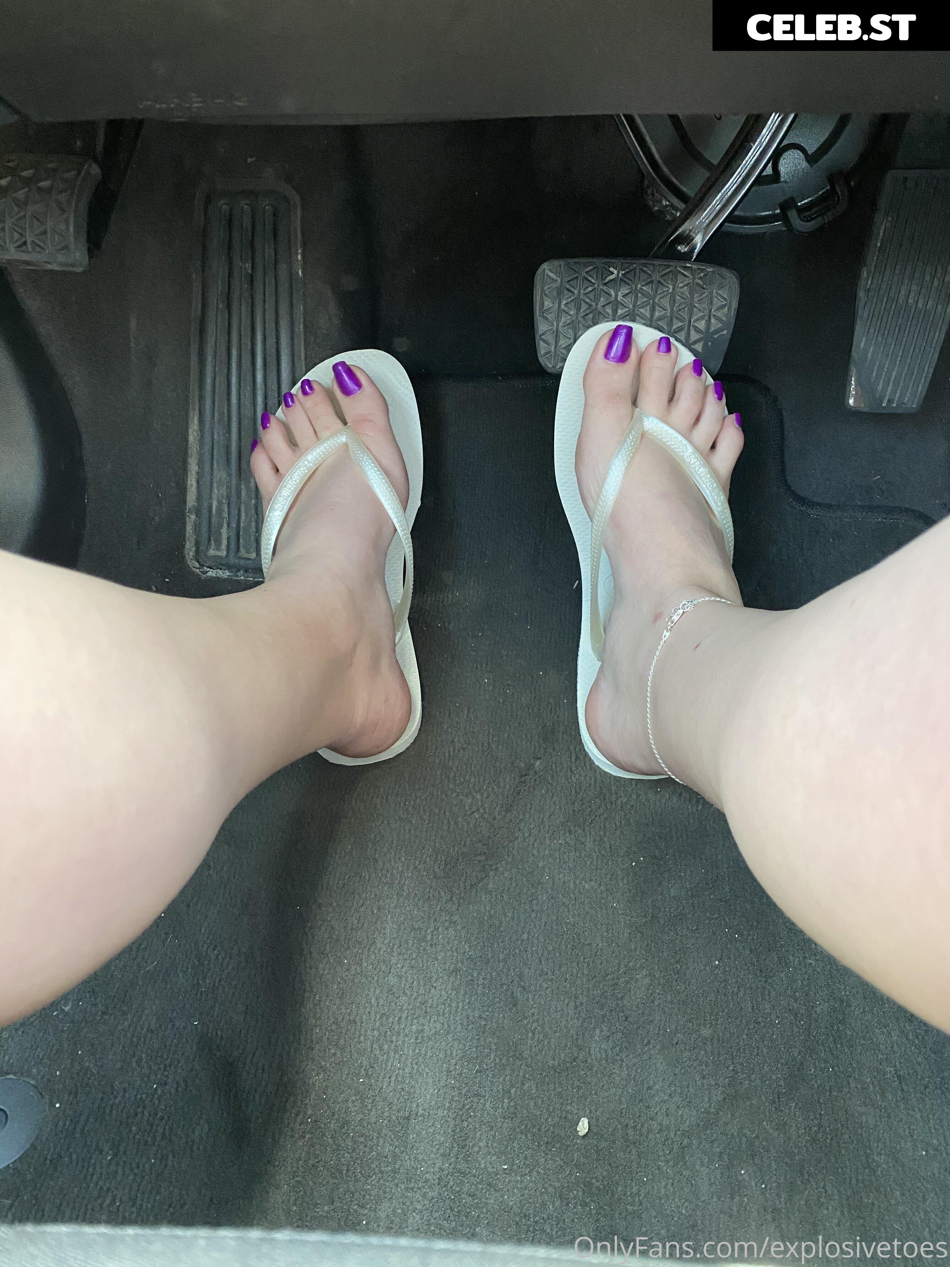explosivetoess Image 17768341